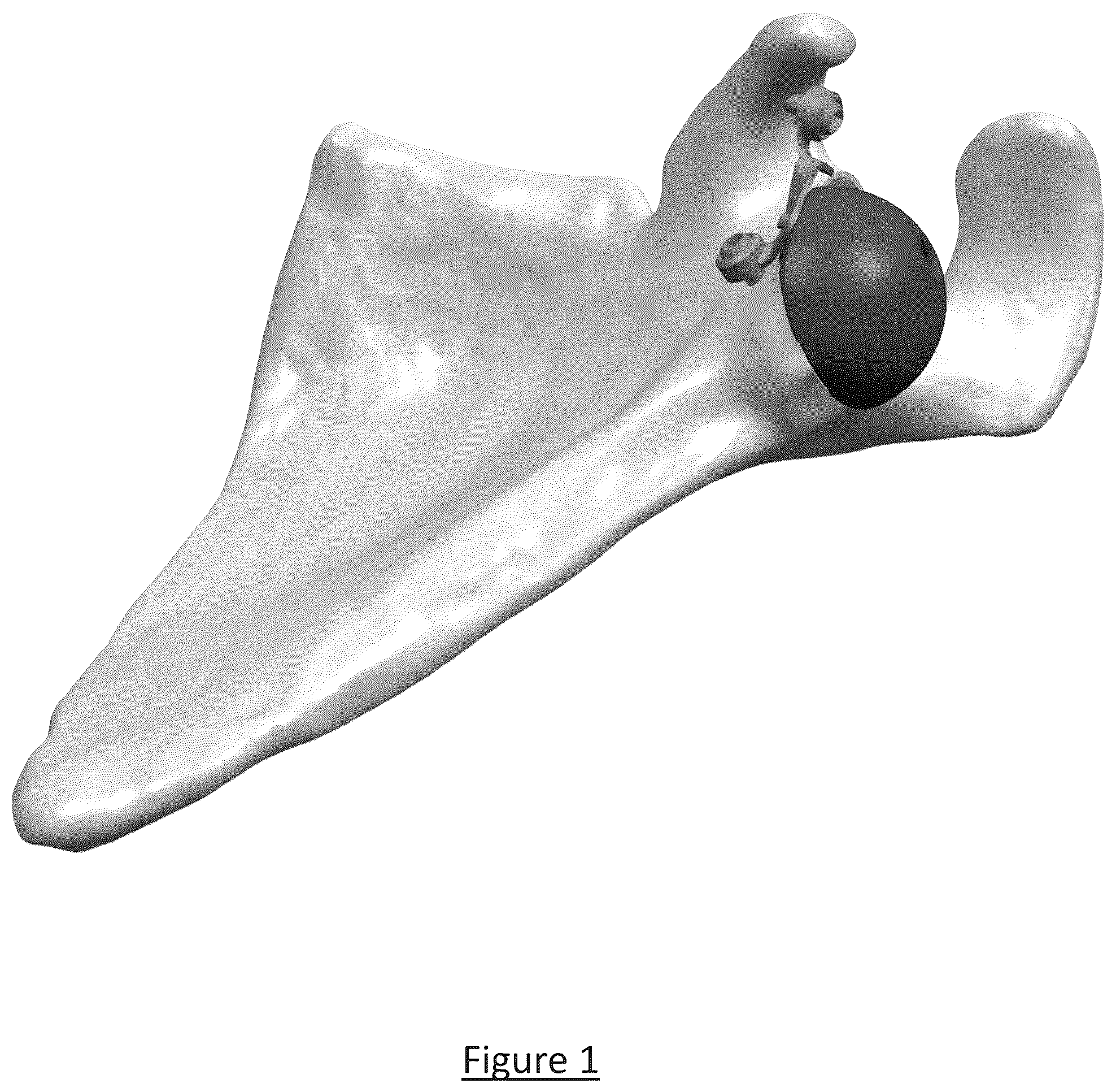 Patent US12310858 — Platform RTSA glenoid prosthesis with modular attachments capable of improving initial fixation, fracture reconstructions, and joint biomechanics — Figure 1