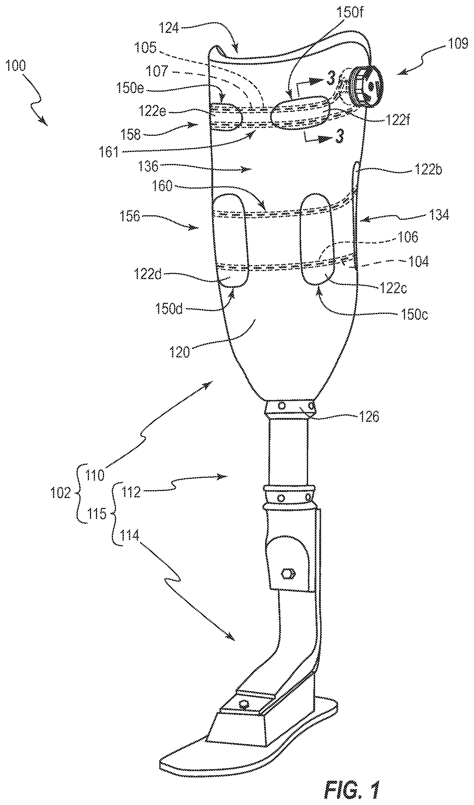 Patent US12310864 — Adjustable prosthetic interfaces and related systems and methods — Figure 1