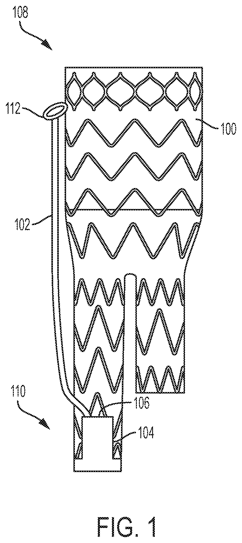 Patent US12310869 Figure 1 – Steering wire attach for angulation