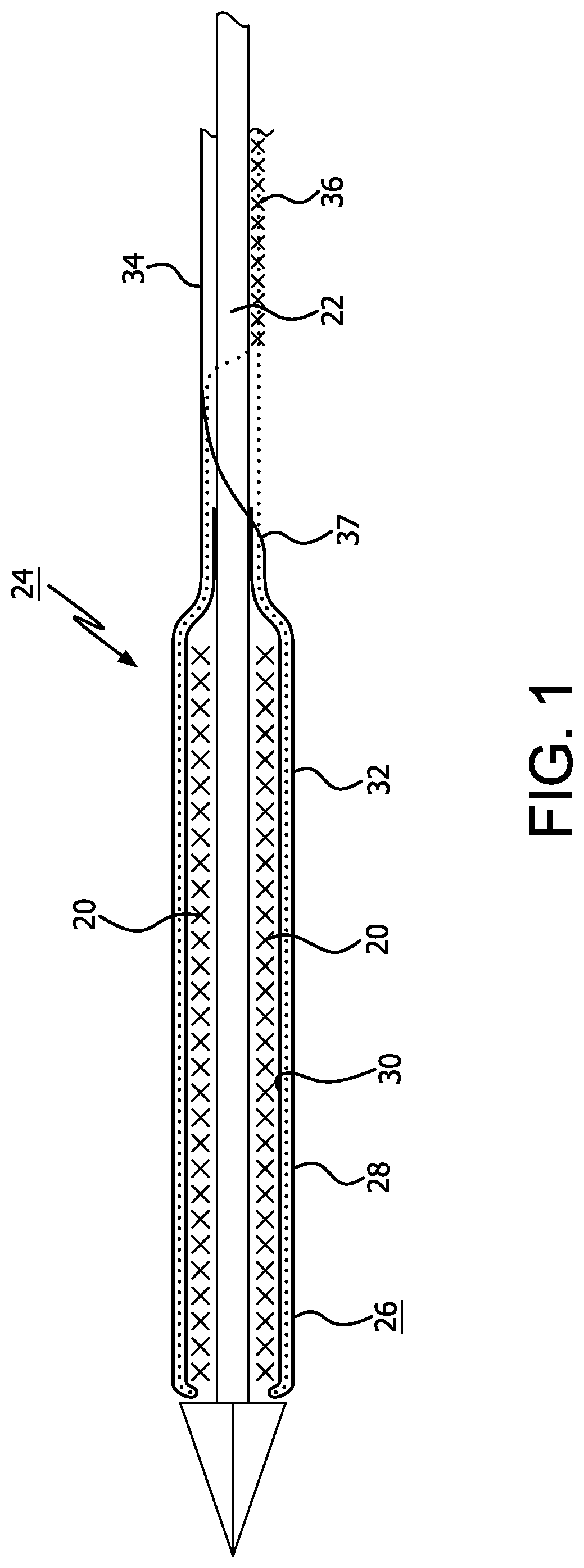 Patent US12310871 — Implantable medical device constraint and deployment apparatus — Figure 1