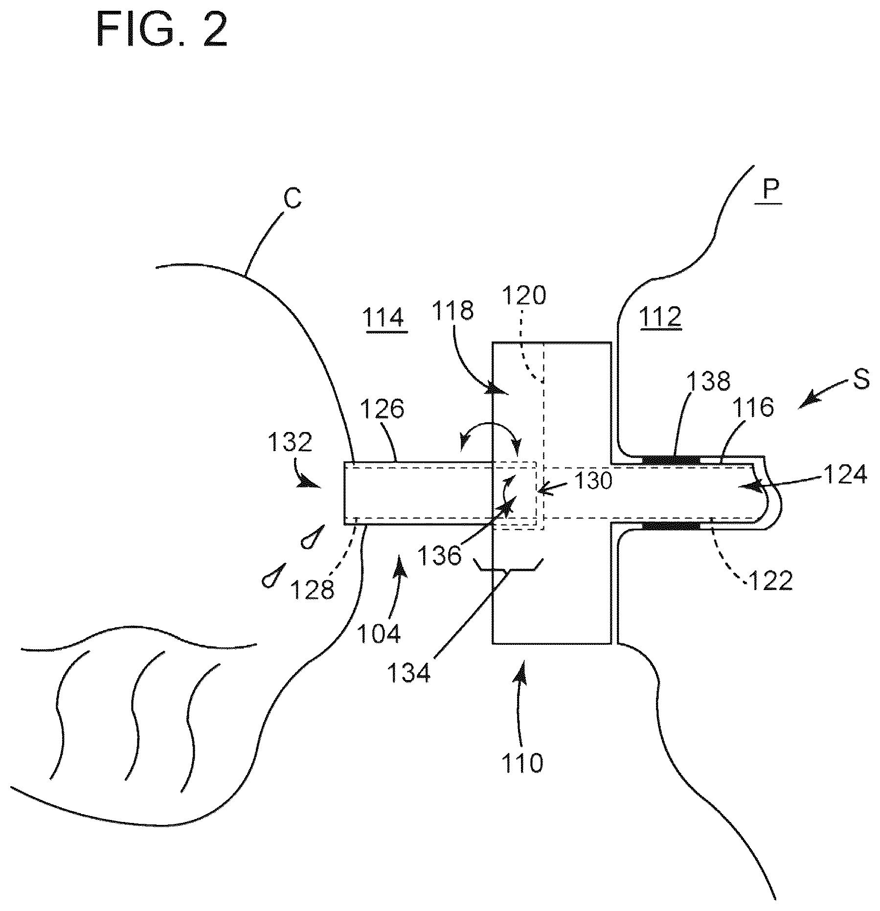 Patent US12310880 Figure 2 – Devices, systems and methods for regulating flow from a stoma on a patient