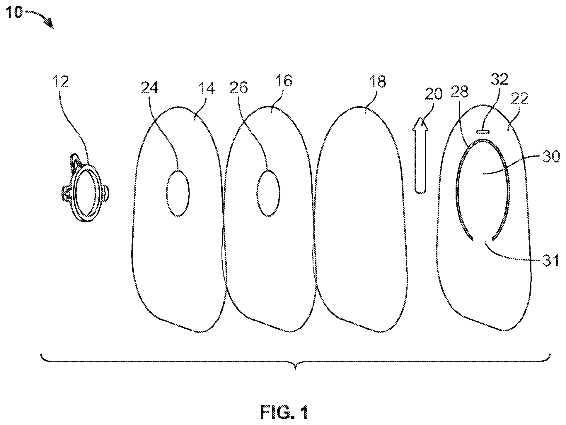 Patent US12310881 Figure 1 – Ostomy pouch with viewing option feature