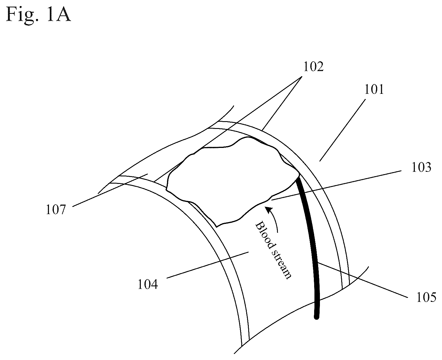 Patent US12310884 — Therapeutic organ cooling — Figure 1