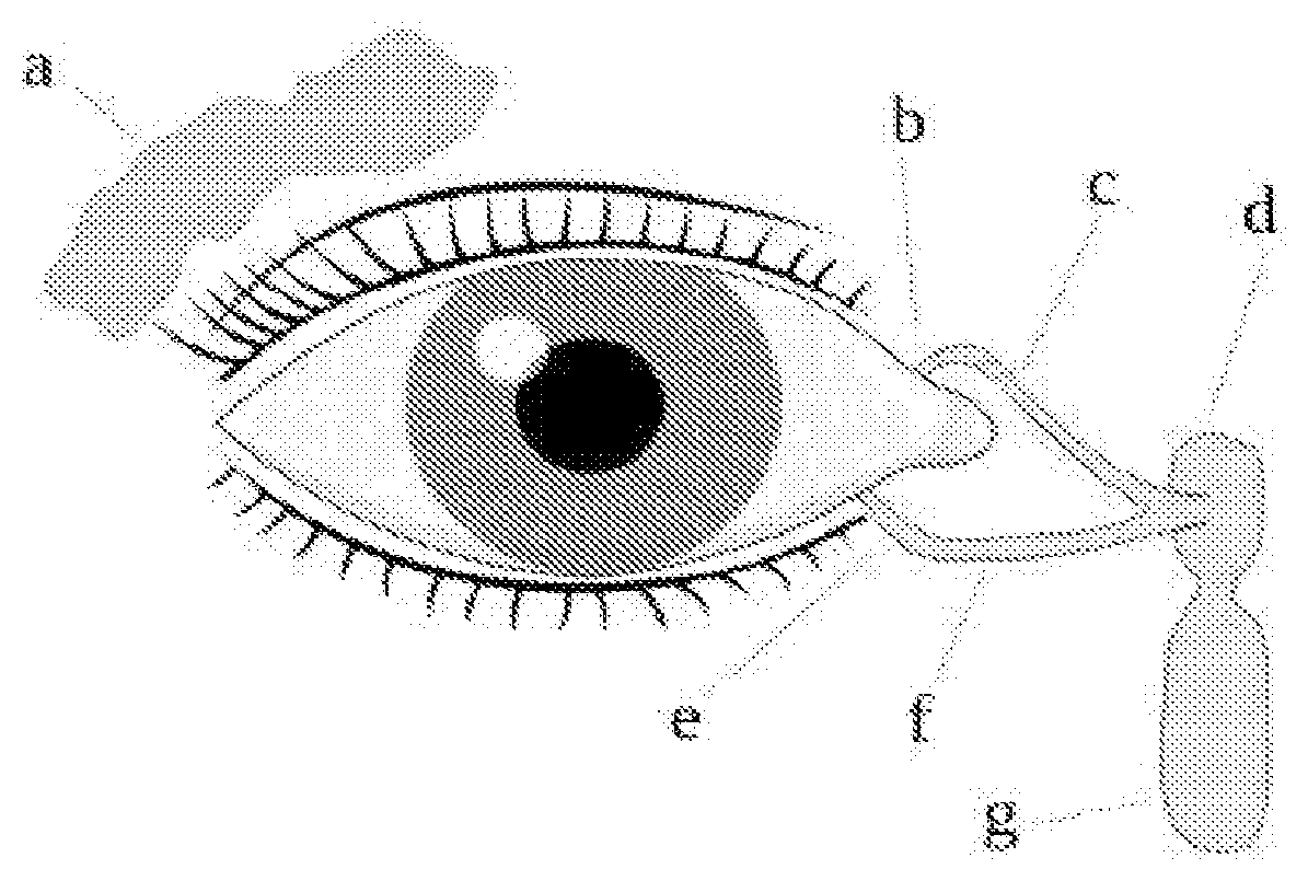 Patent US12310890 Figure 1 – Punctal plug and bioadhesives