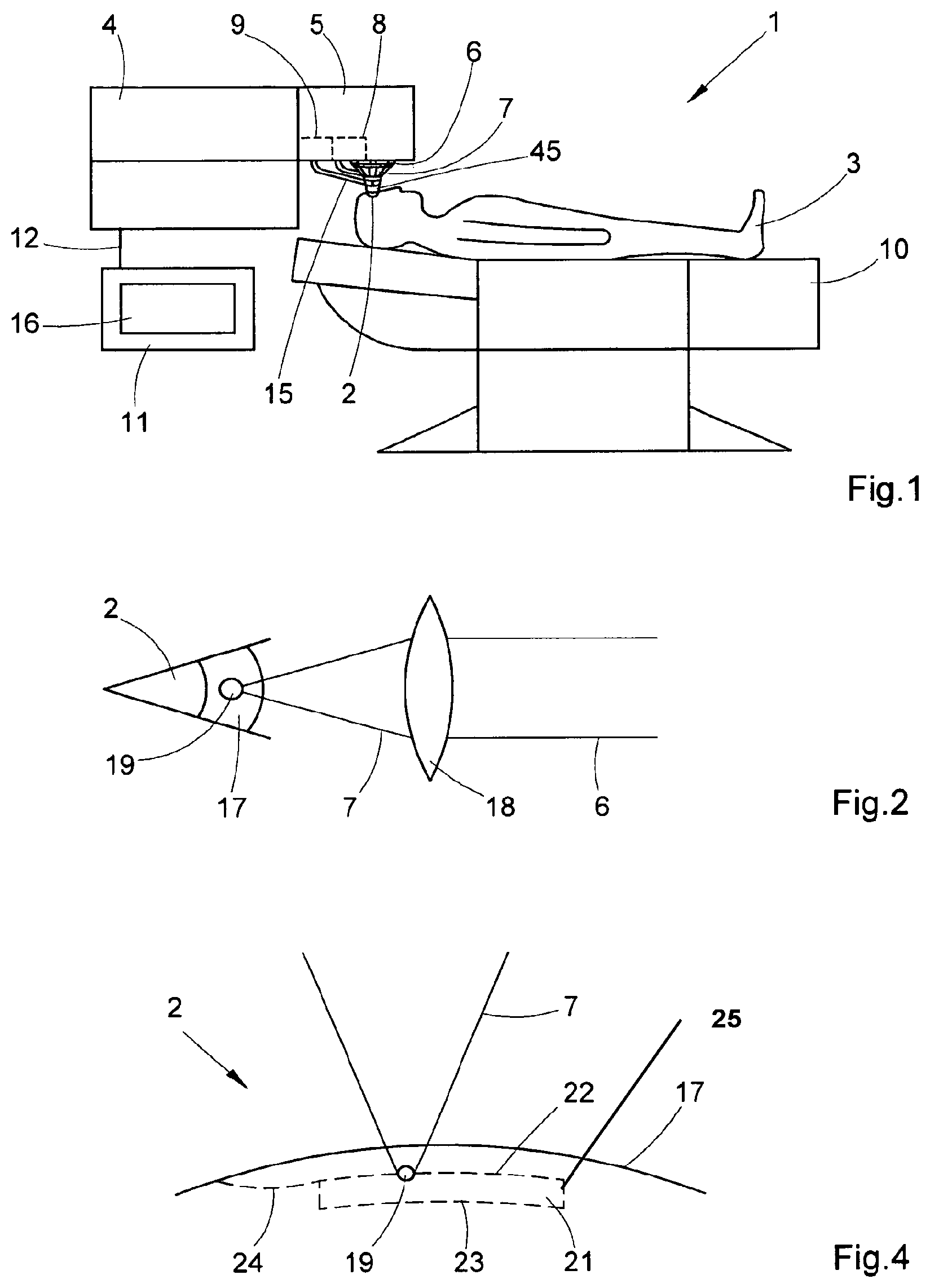 Patent US12310894 Figure 1 – Post-treatment in refraction correction during eye surgery