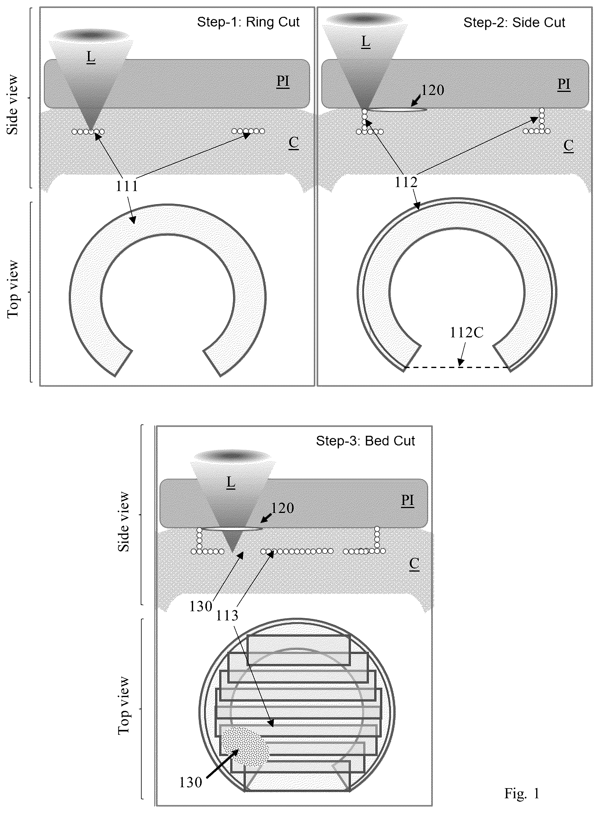 Patent US12310895 — Lasik flap cutting patterns including bubble barrier layer in side cut for bubble management — Figure 1