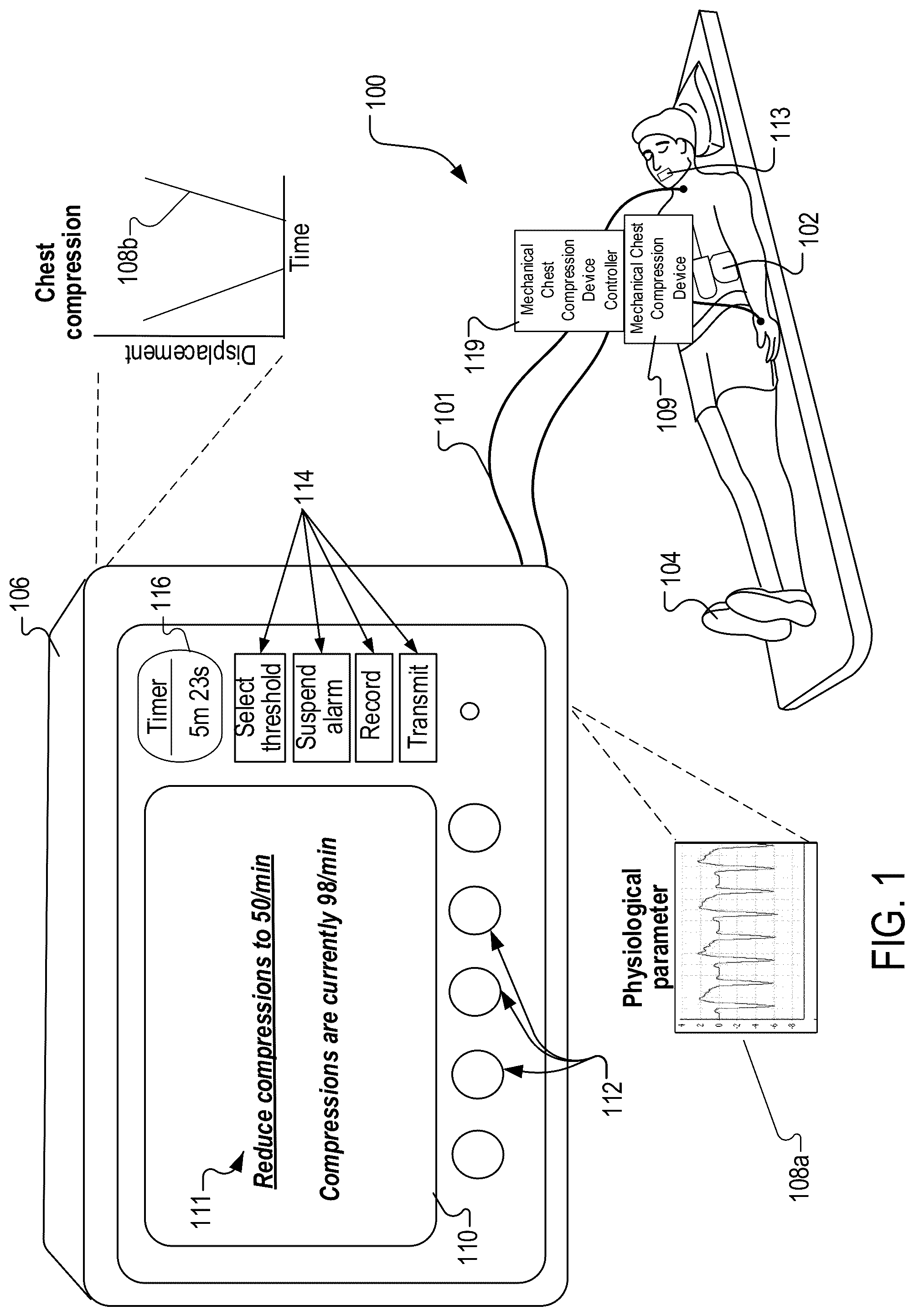 Patent US12310917 — Assisting a CPR treatment — Figure 1