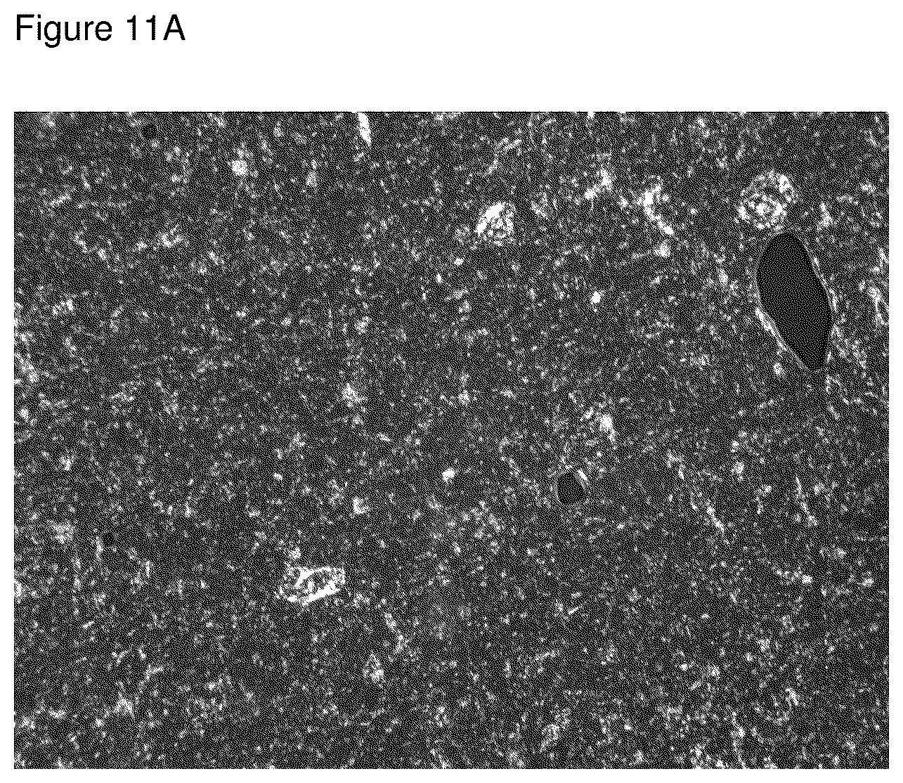 Patent US12310956 Figure 11 – Topical roflumilast formulation having improved delivery and plasma half-life