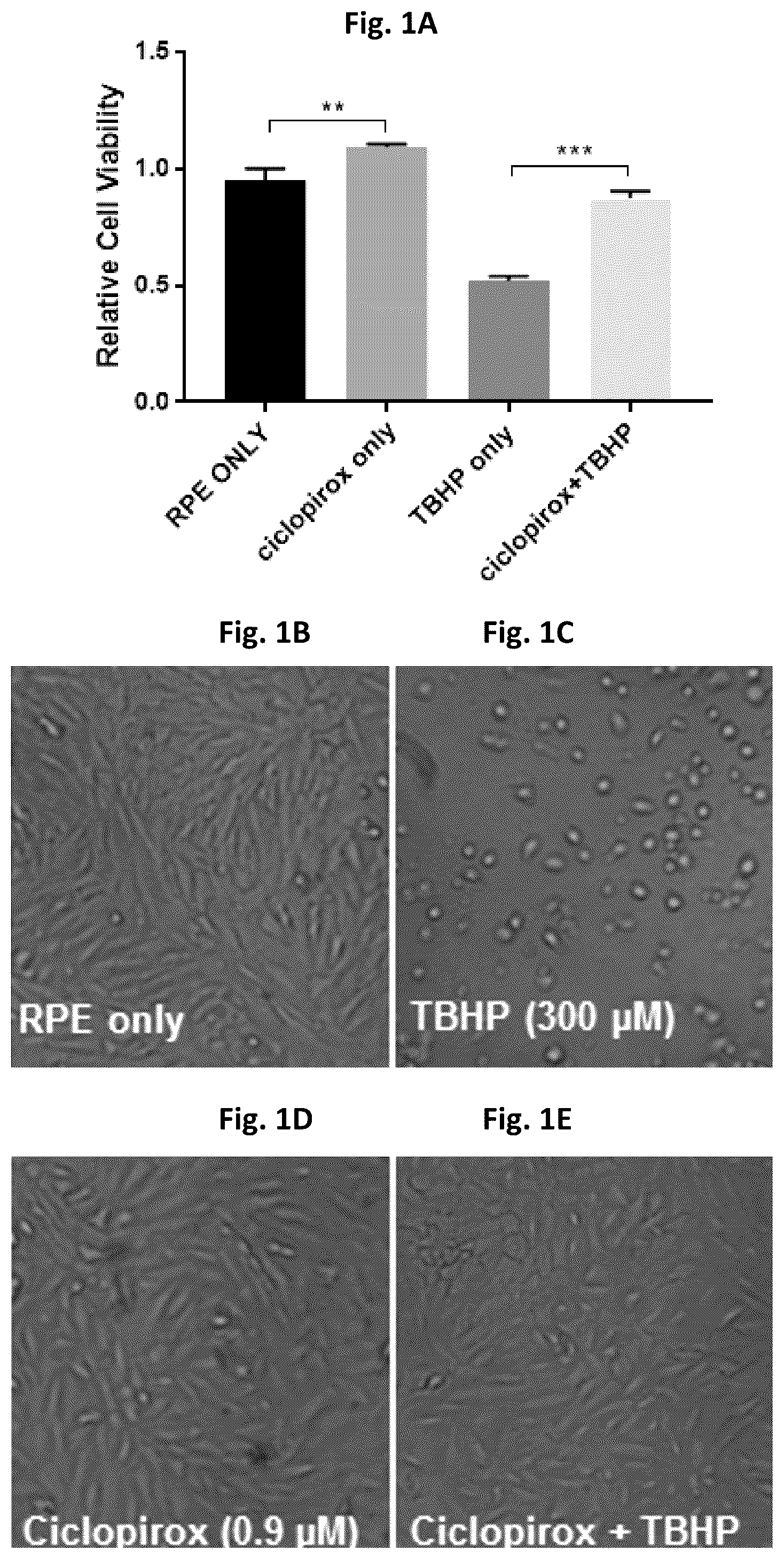 Patent US12310970 — Compounds and methods for treating or preventing anterior segment ocular disorders and/or retinal degenerations — Figure 1