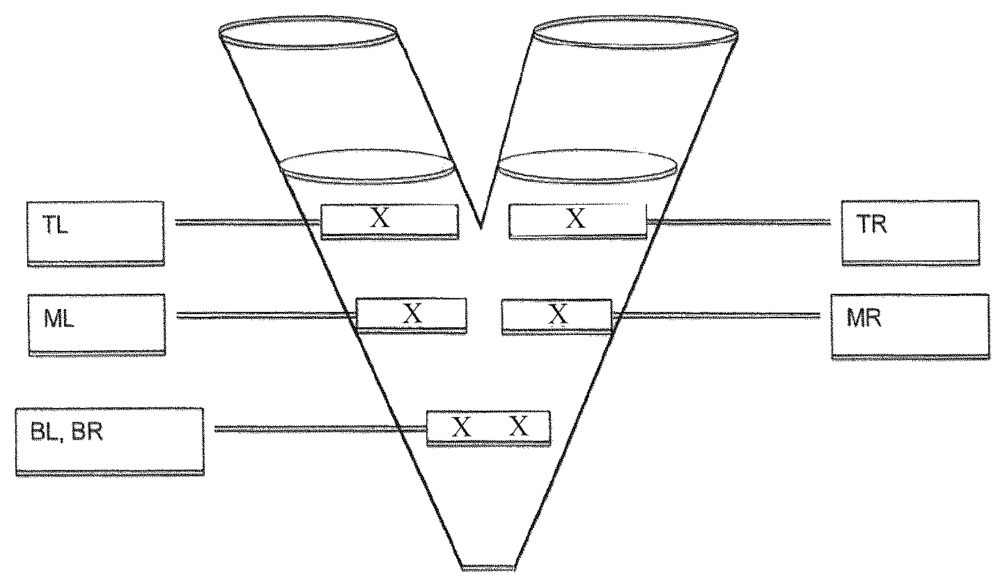 Patent US12310976 — Corticosteroid containing orally disintegrating tablet compositions for eosinophilic esophagitis — Figure 1