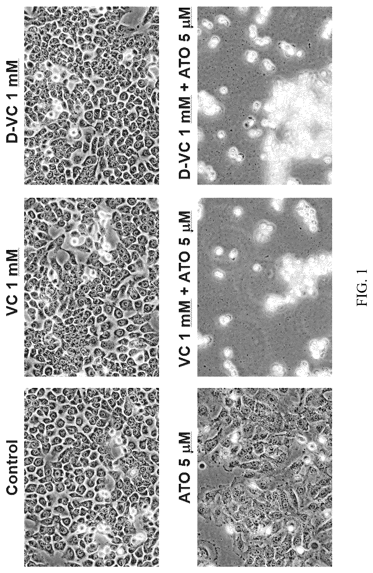 Patent US12310986 — Compositions and methods for the treatment of cancer cells by induction of cytotoxic oxidative stress — Figure 1