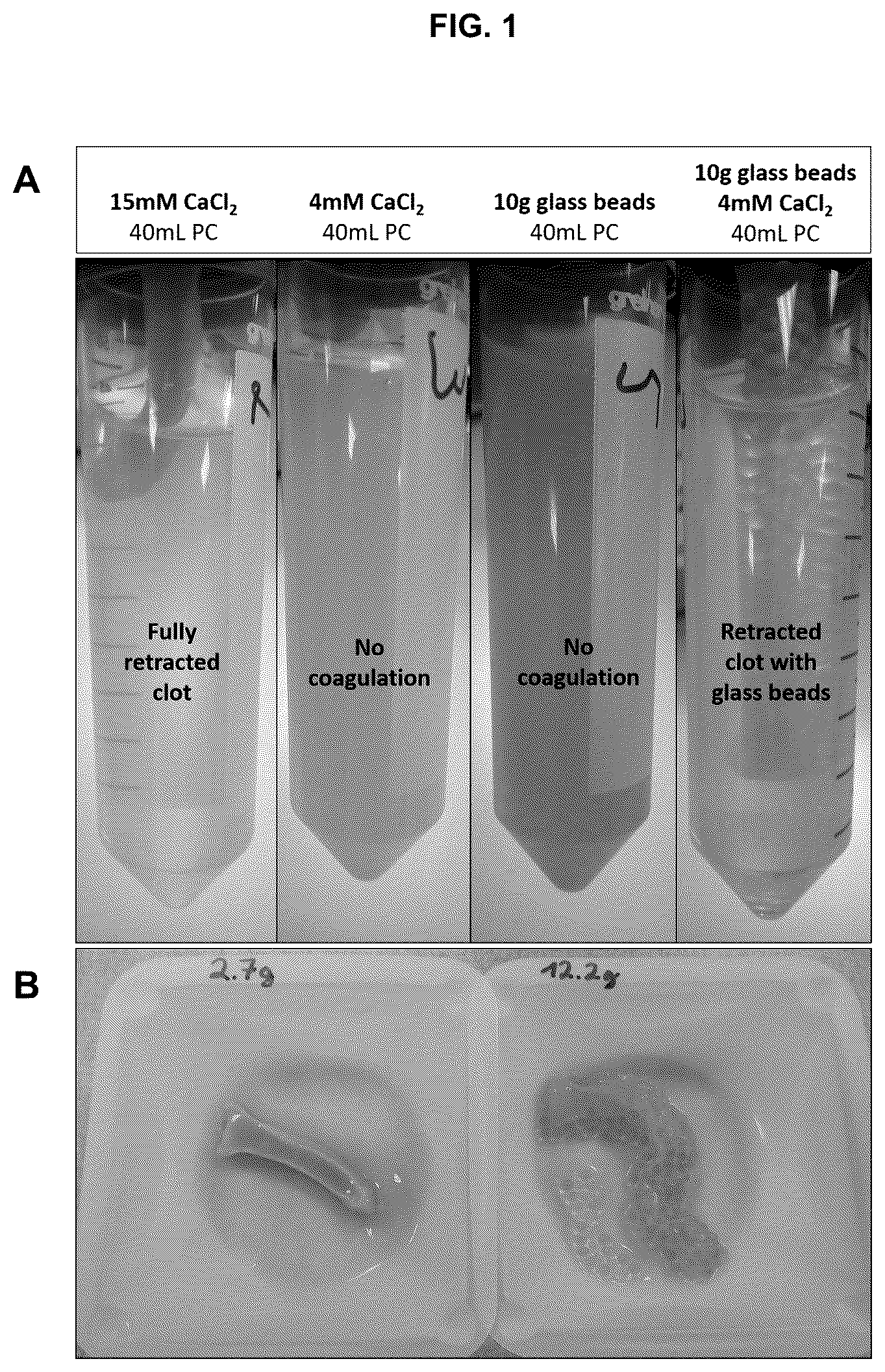 Patent US12310989 Figure 1 – Methods for preparing platelet releasate