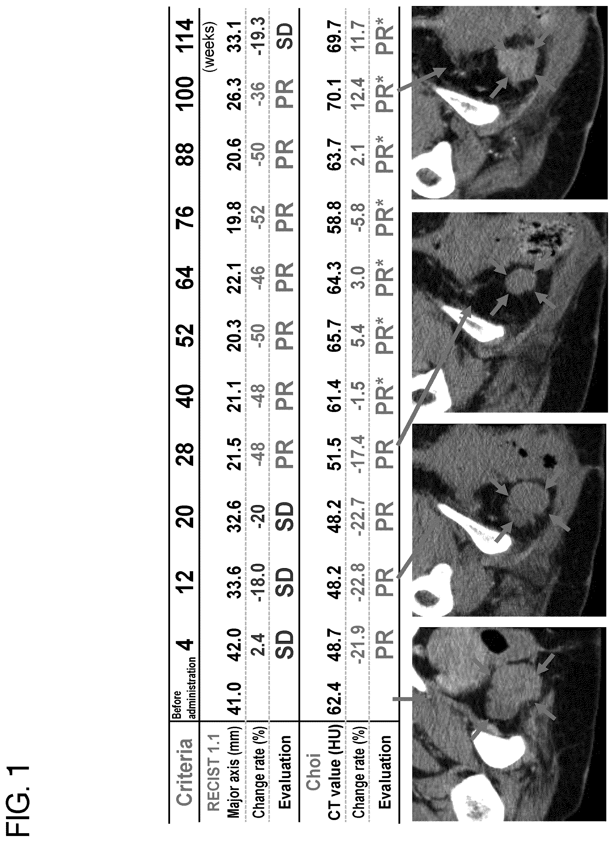 Patent US12310998 — Therapeutic pharmaceutical composition for bone and soft tissue tumors — Figure 1