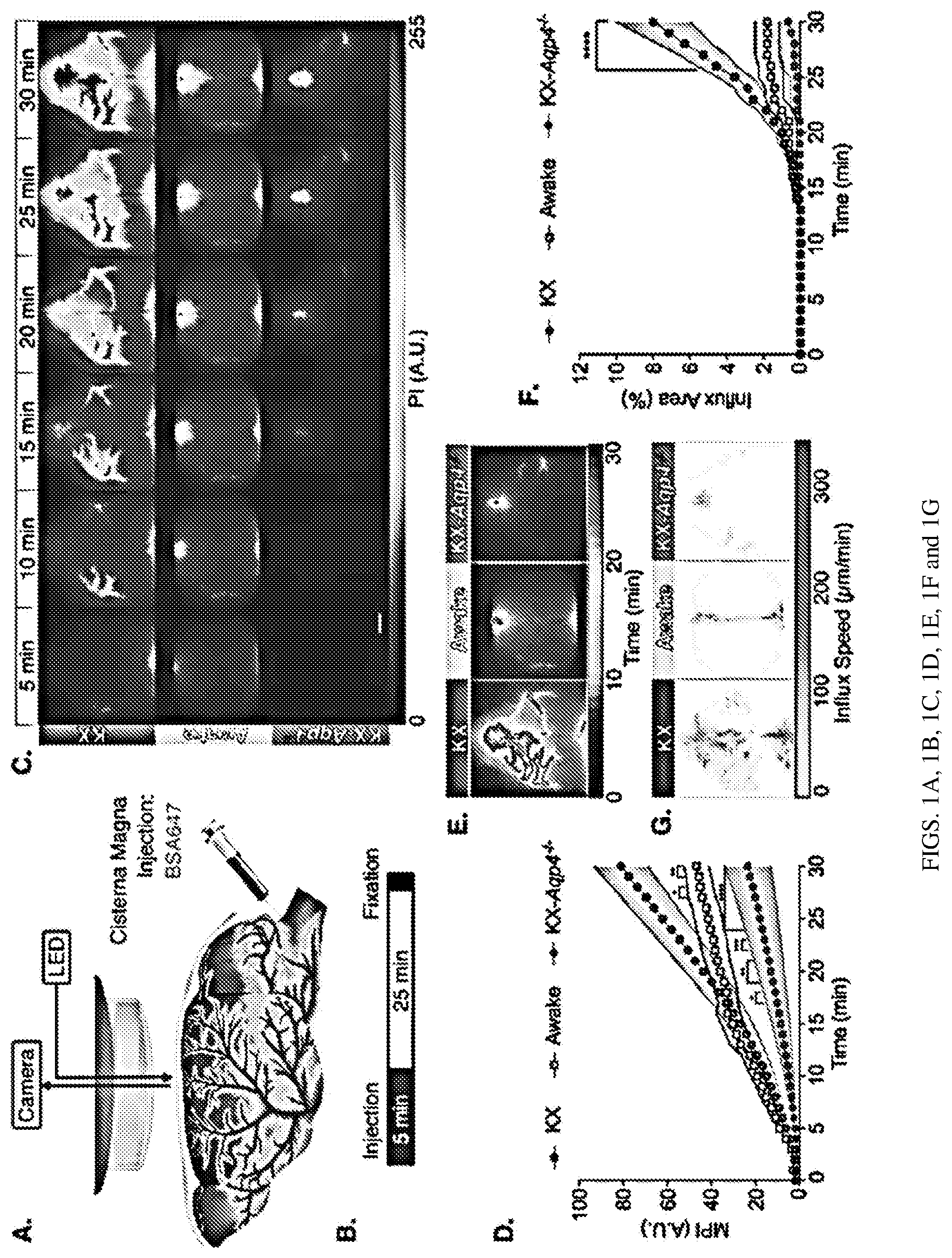 Patent US12311035 — Glymphatic delivery by manipulating plasma osmolarity — Figure 1