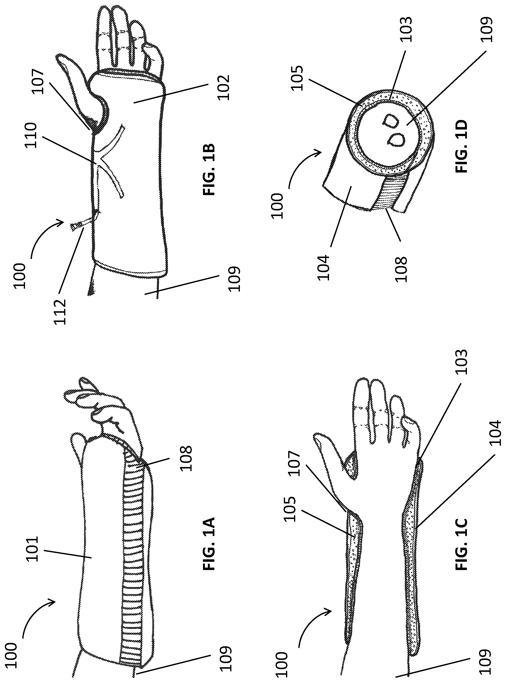 Patent US12311062 Figure 1 – Expanding foam-fabric orthopedic limb stabilization device