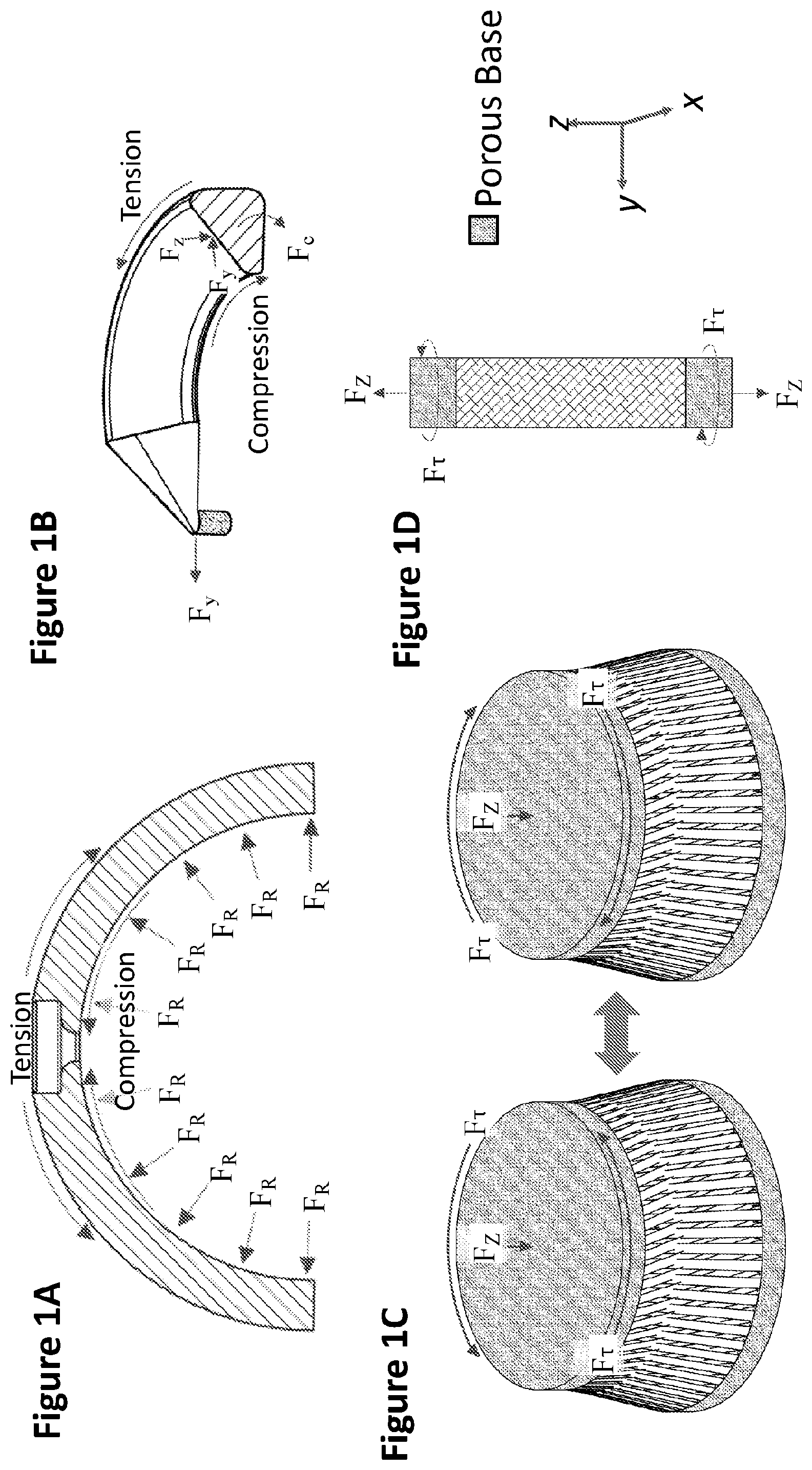 Patent US12311077 — Method of making, manufacturing or producing orthopedic soft tissue — Figure 1