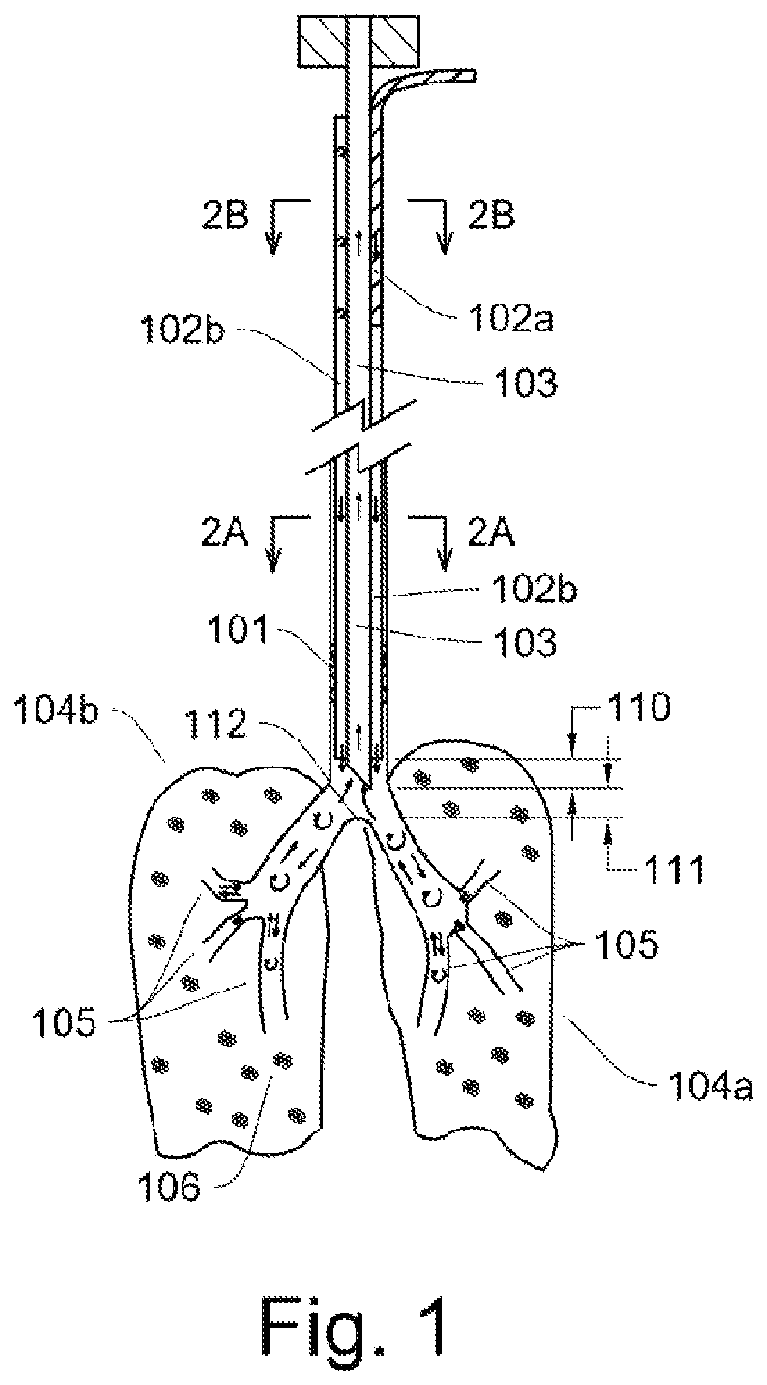 Patent US12311102 — Lung ventilator system and method of ventilating lungs in breathing and non-breathing patients — Figure 1