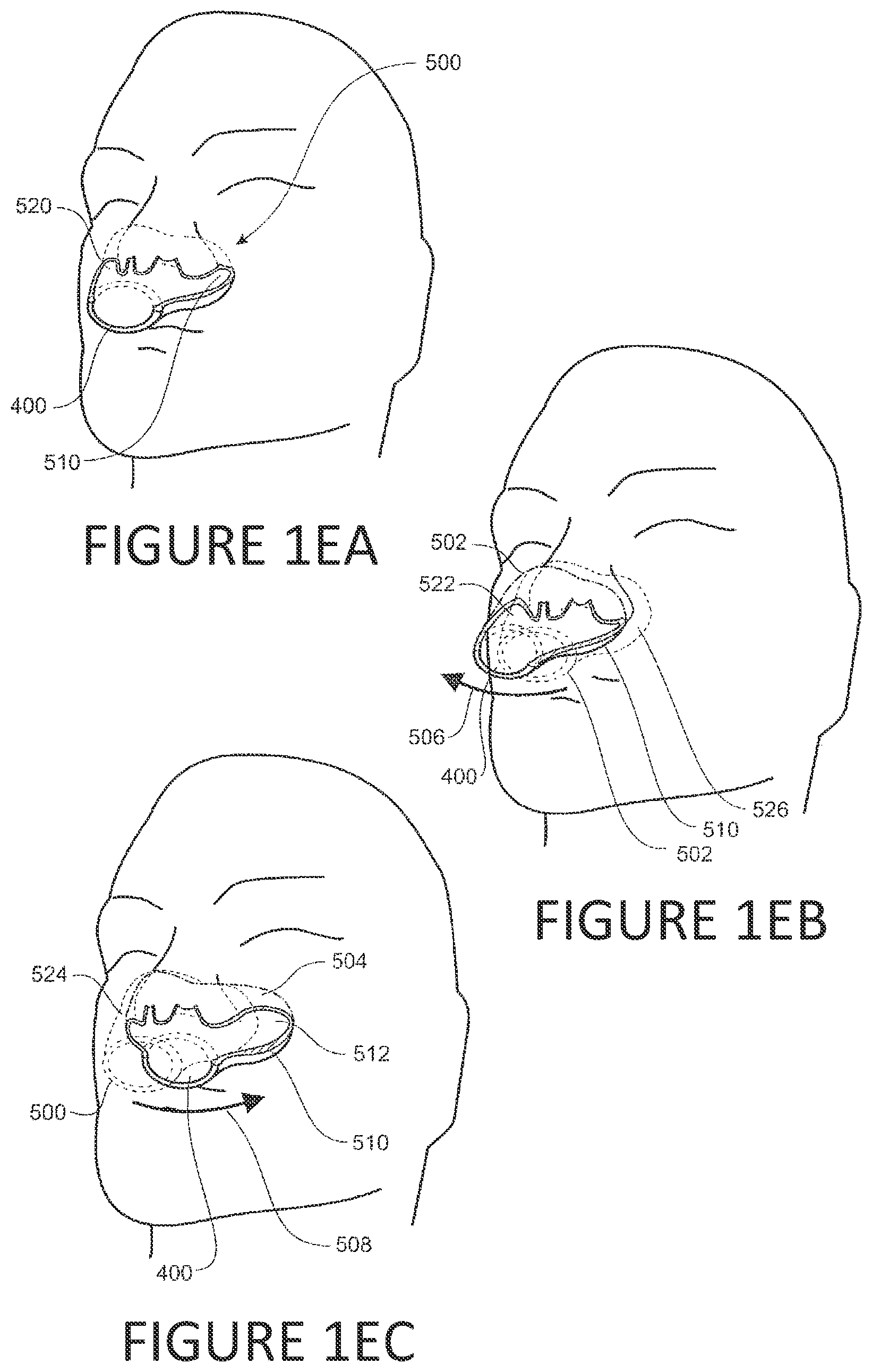 Patent US12311109 Figure 5 – Frame with supporting arms and length adjustable strap