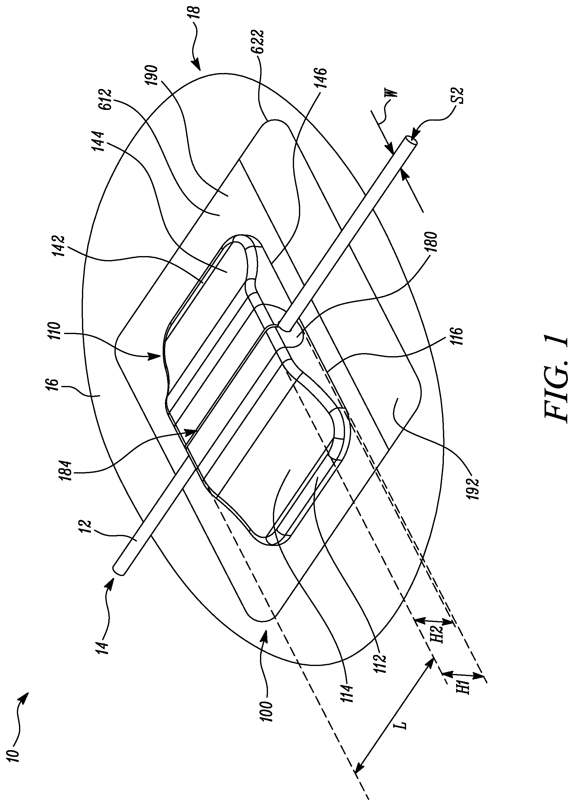 Patent US12311126 — Securement device, kit comprising securement device, and method of securing securement device on skin of user — Figure 1