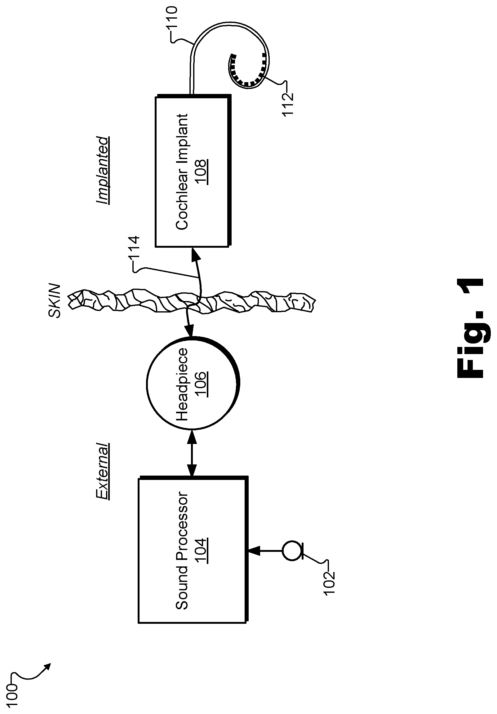 Patent US12311172 — Systems and methods for measuring evoked responses from a brain of a patient — Figure 1