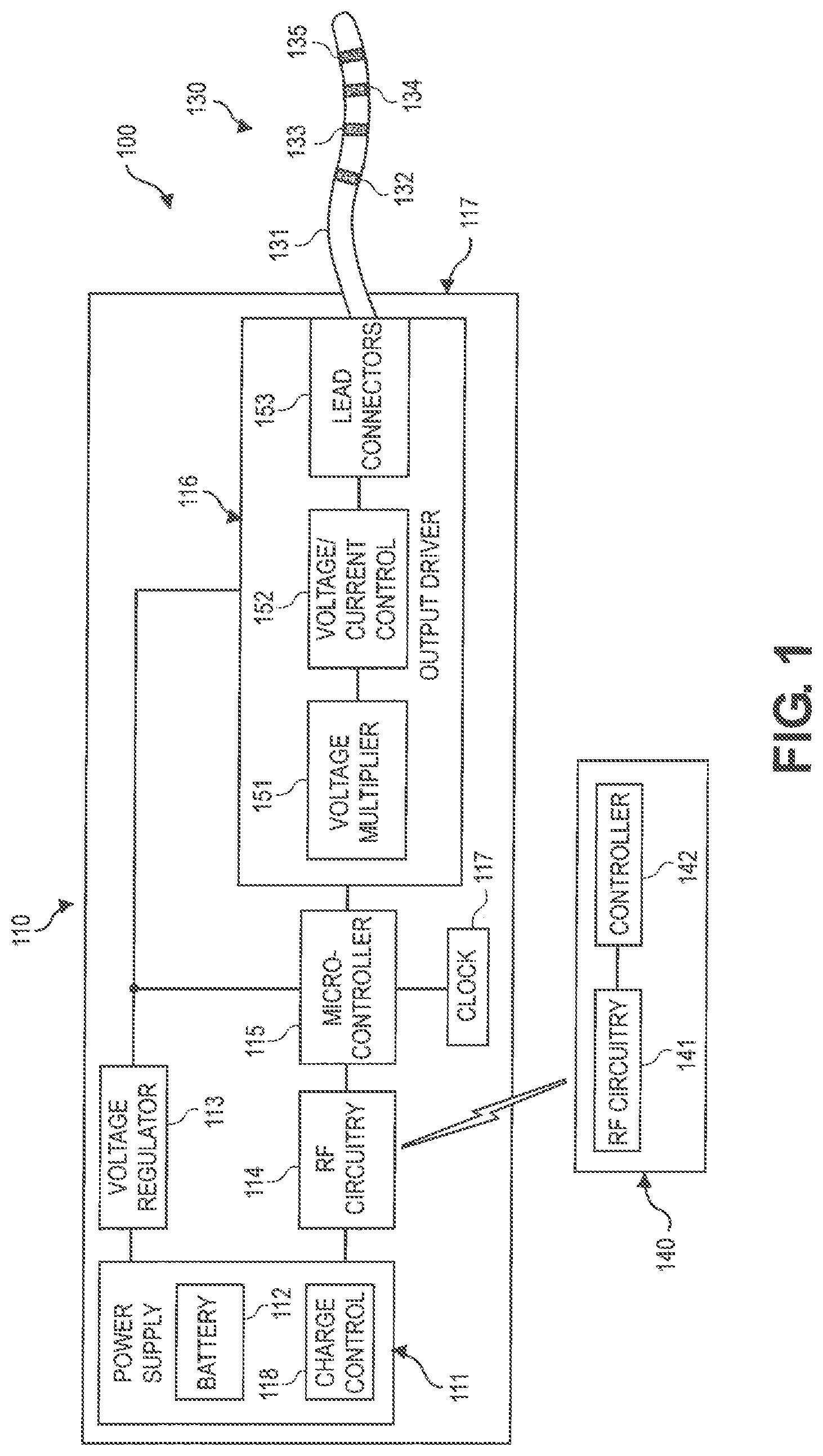Patent US12311185 — Implantable pulse generator for providing a neurostimulation therapy using complex impedance measurements and methods of operation — Figure 1