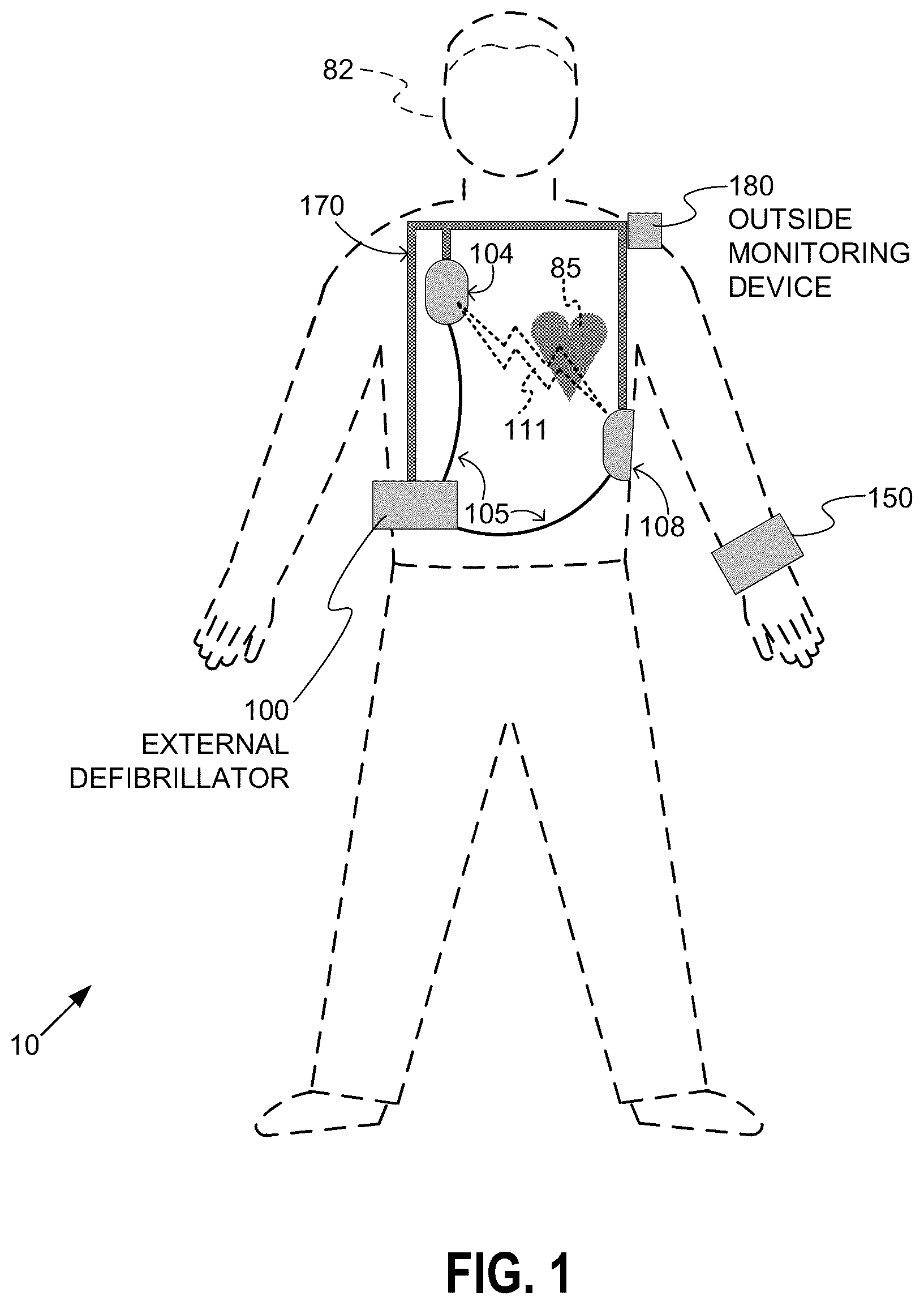Patent US12311188 Figure 1 – Power in a wearable cardioverter defibrillator (WCD)