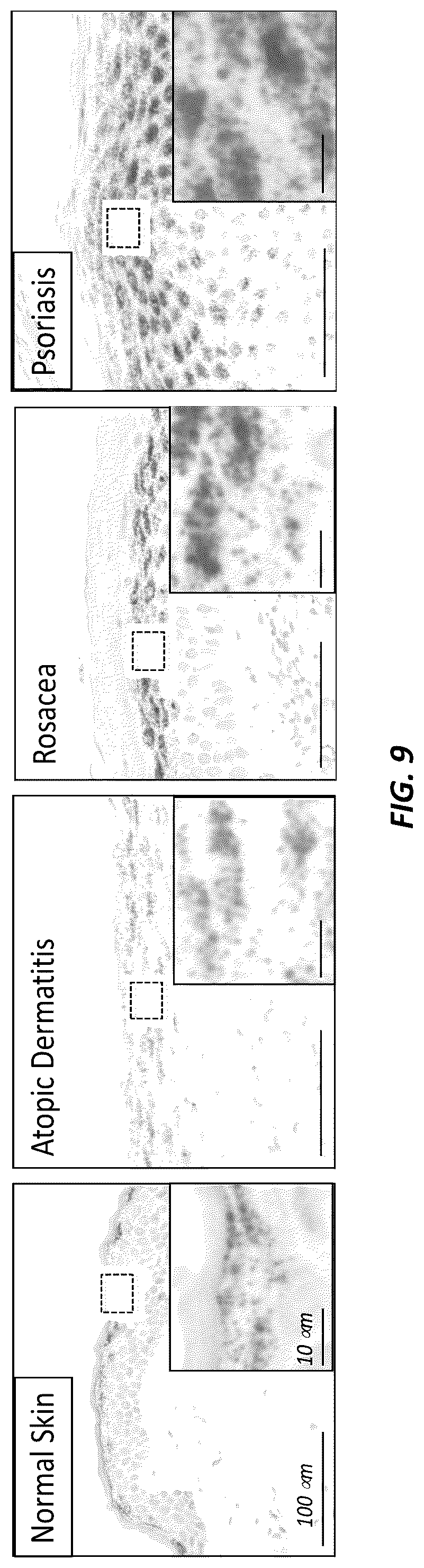 Patent US12312415 Figure 13 – Anti-KLK7 antibodies, anti-KLK5 antibodies, multispecific anti-KLK5/KLK7 antibodies, and methods of use