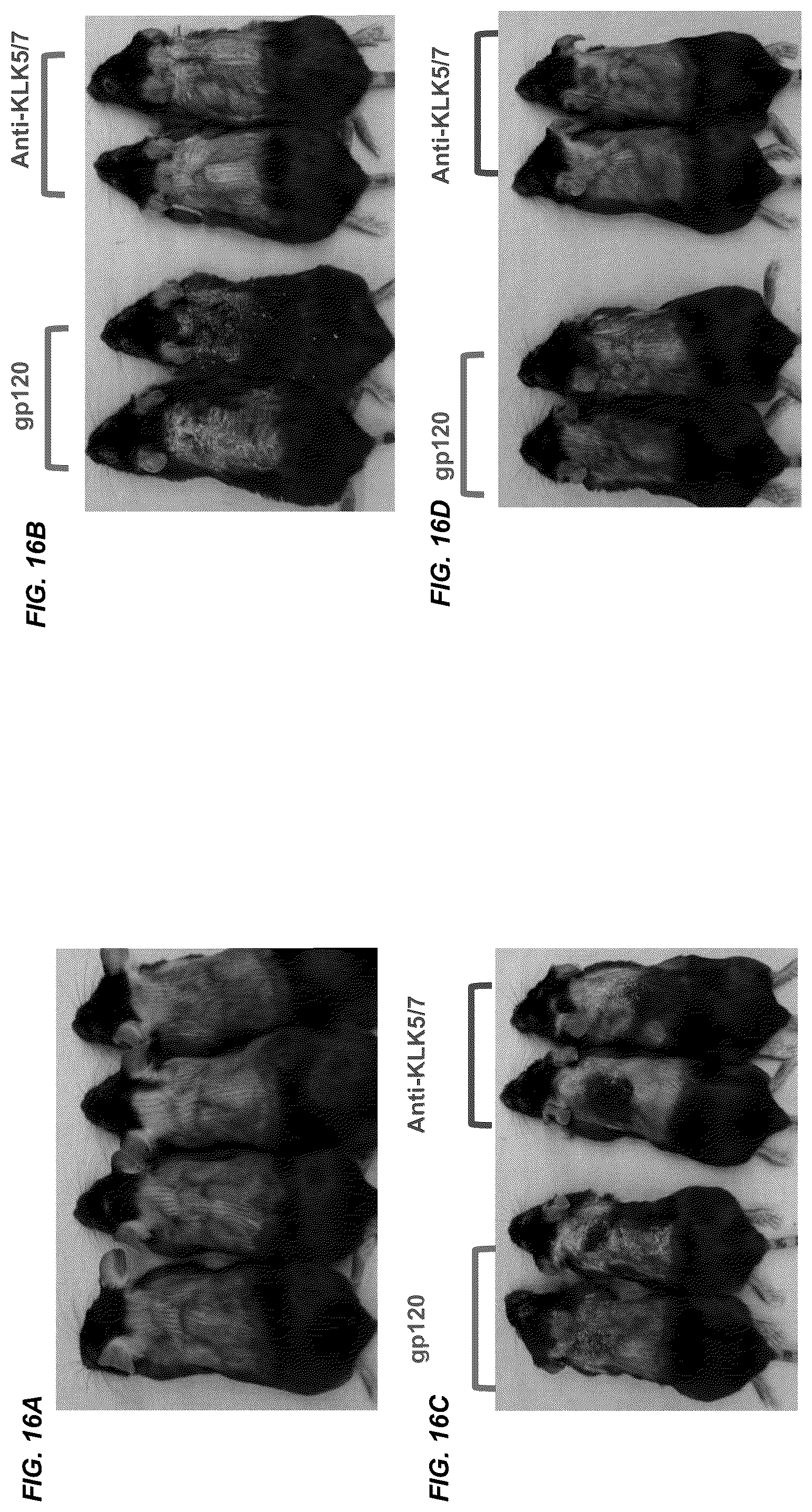 Patent US12312415 Figure 20 – Anti-KLK7 antibodies, anti-KLK5 antibodies, multispecific anti-KLK5/KLK7 antibodies, and methods of use