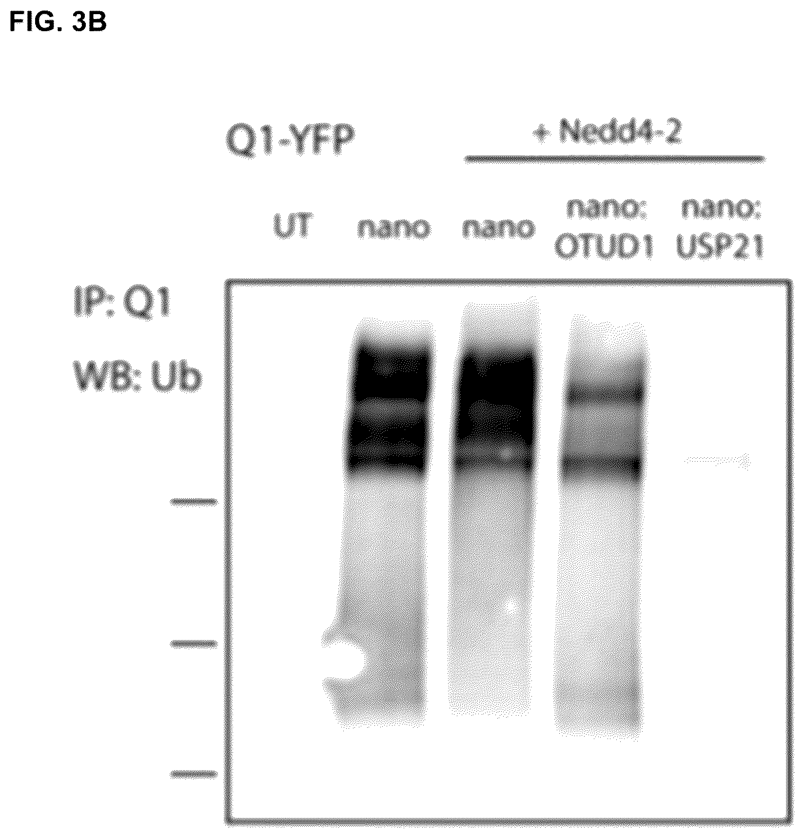 Patent US12312618 Figure 4 – Compositions and methods for using engineered deubiquitinases for probing ubiquitin-dependent cellular processes