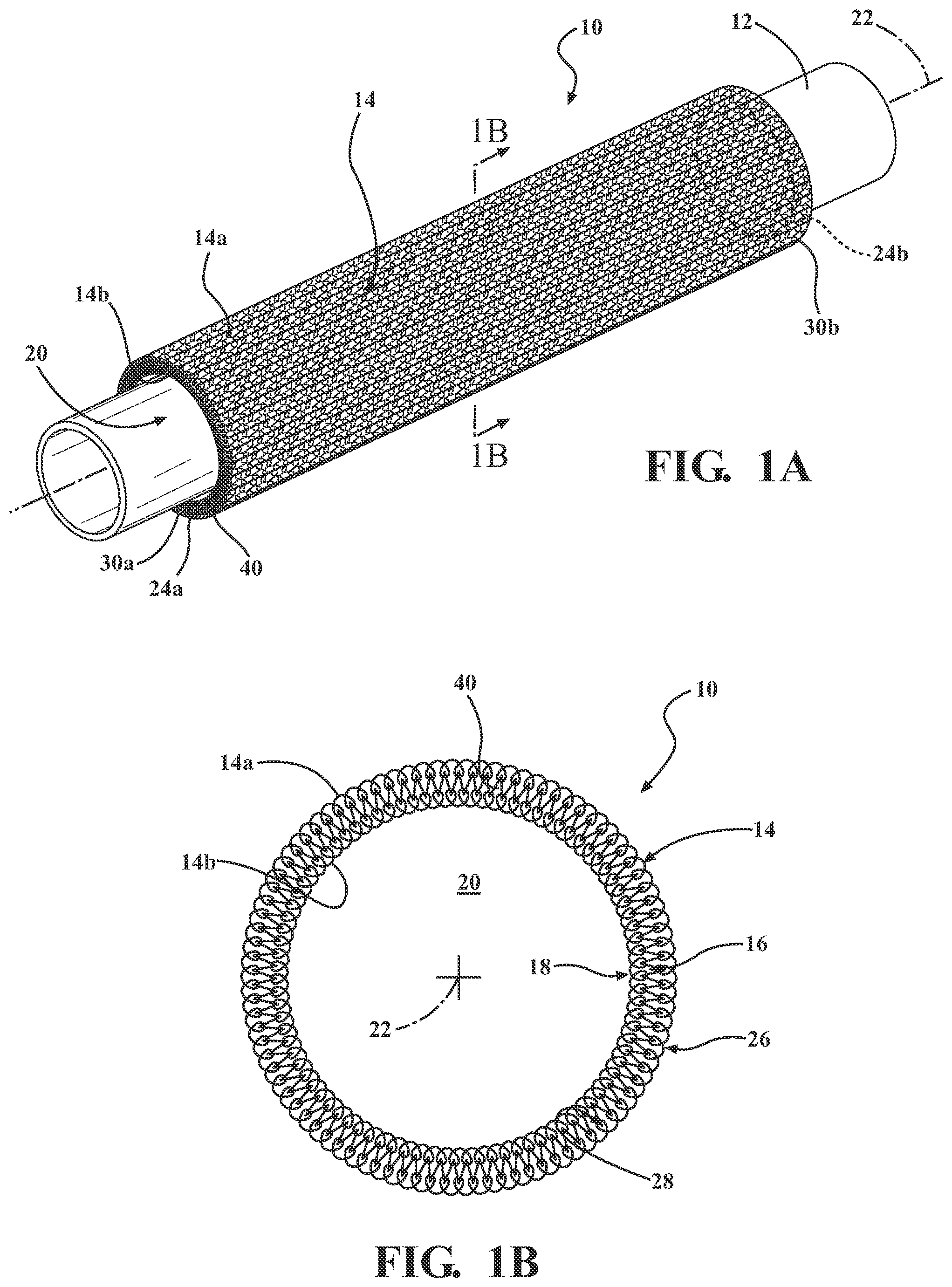Patent US12312717 Figure 1 – Tubular protective sleeve having a knitted dual layer wall and method of construction thereof