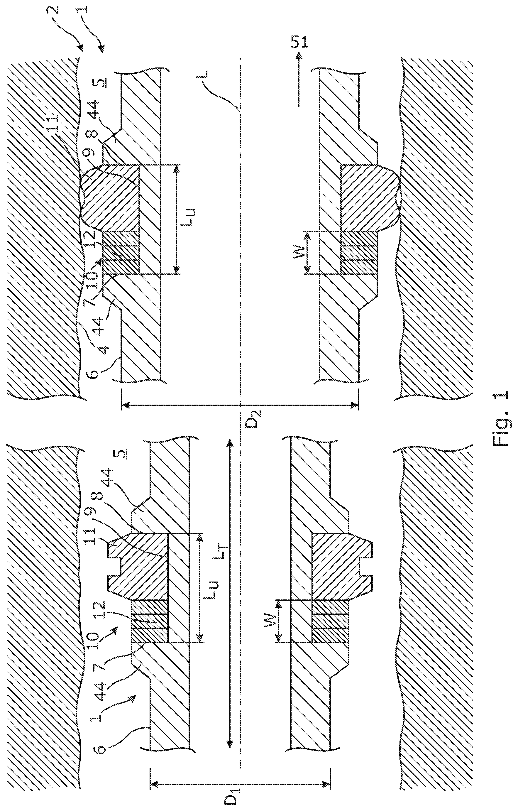 Patent US12312901 Figure 1 – Downhole expandable tubular
