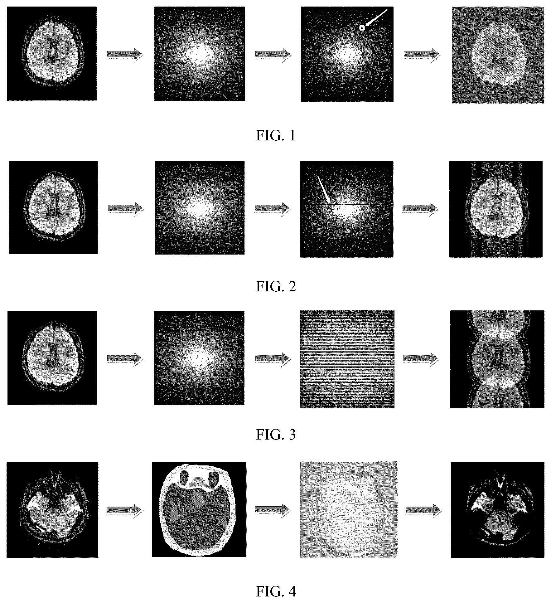 Patent US12313716 — Method and system for simulating magnetic resonance echo-planar imaging artifact — Figure 1