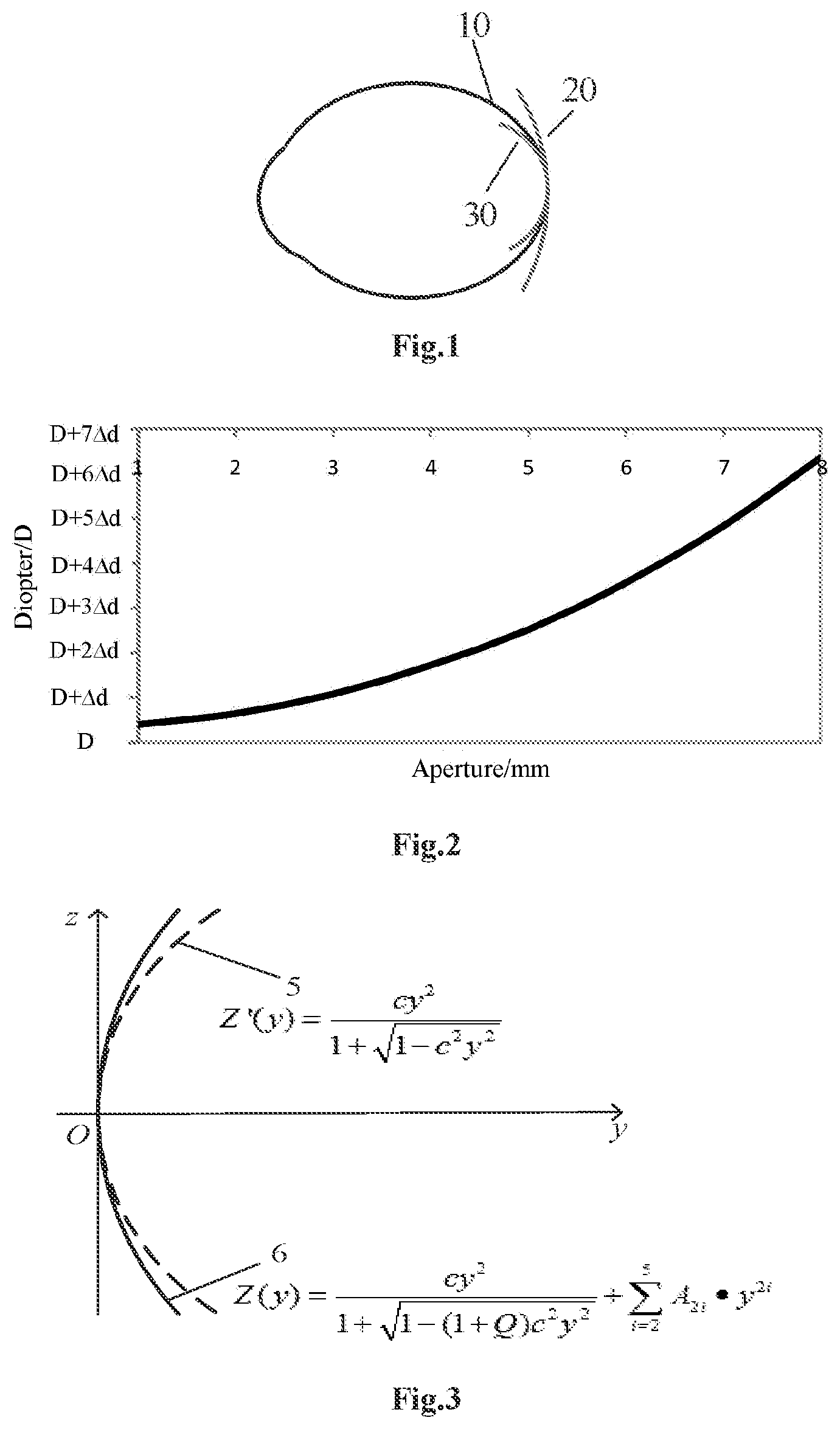 Patent US12313918 — Vision correction lens and method for preparation of the same — Figure 1