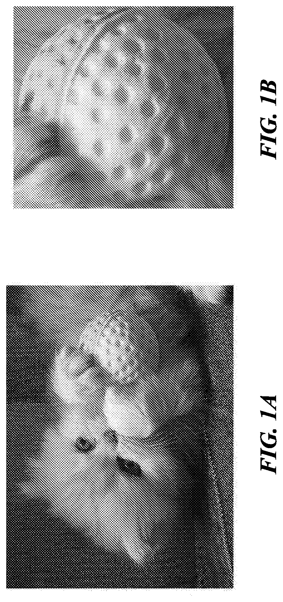 Patent US12315053 Figure 1 – Image classification through label progression