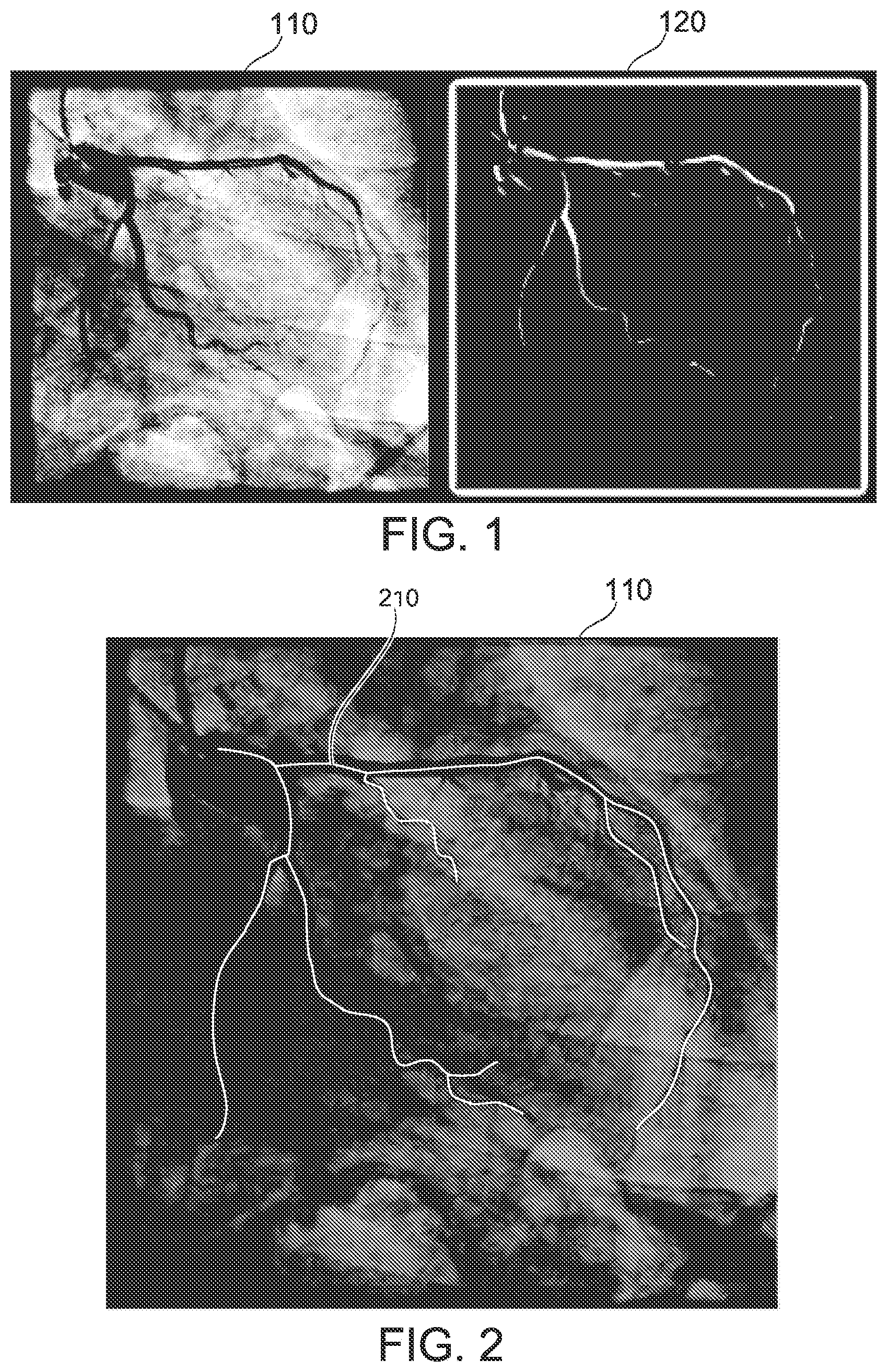 Patent US12315076 — Four-dimensional motion analysis of a patient's coronary arteries and myocardial wall — Figure 1