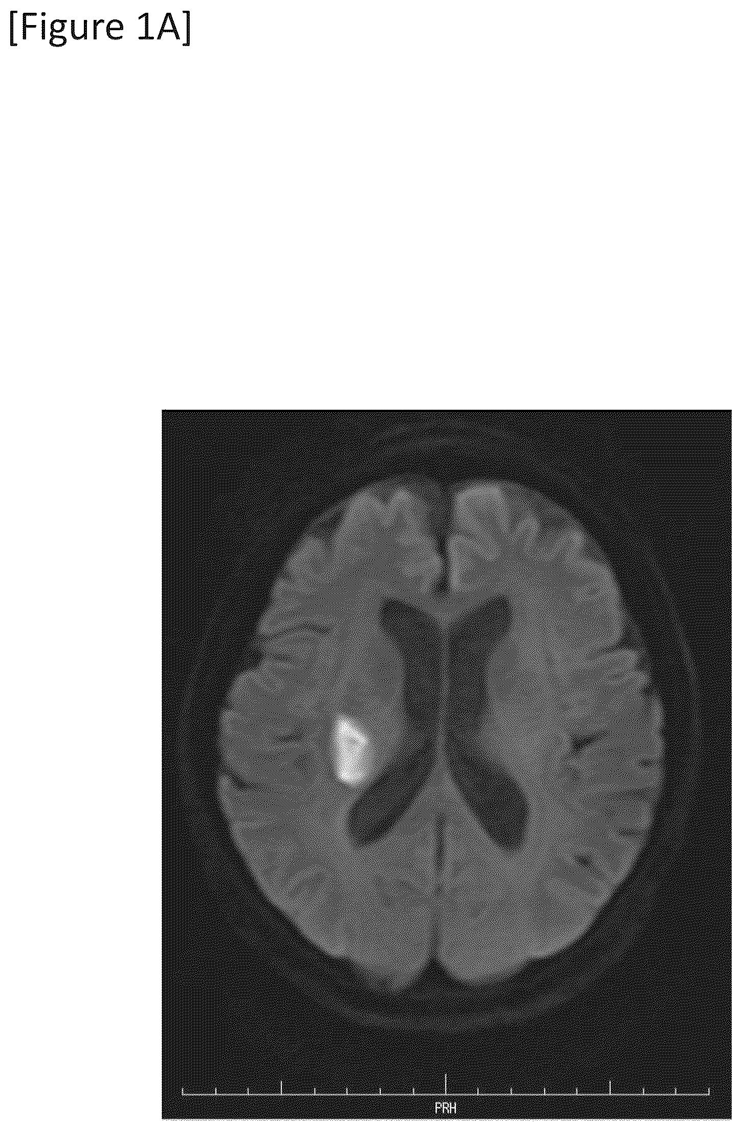 Patent US12315148 — Integrated system for safe intracranial administration of cells — Figure 1