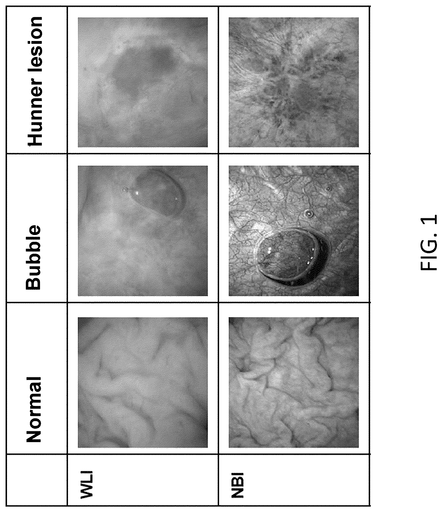 Patent US12315150 — Program for indicating Hunner lesion, learned model, and method for generating same — Figure 1