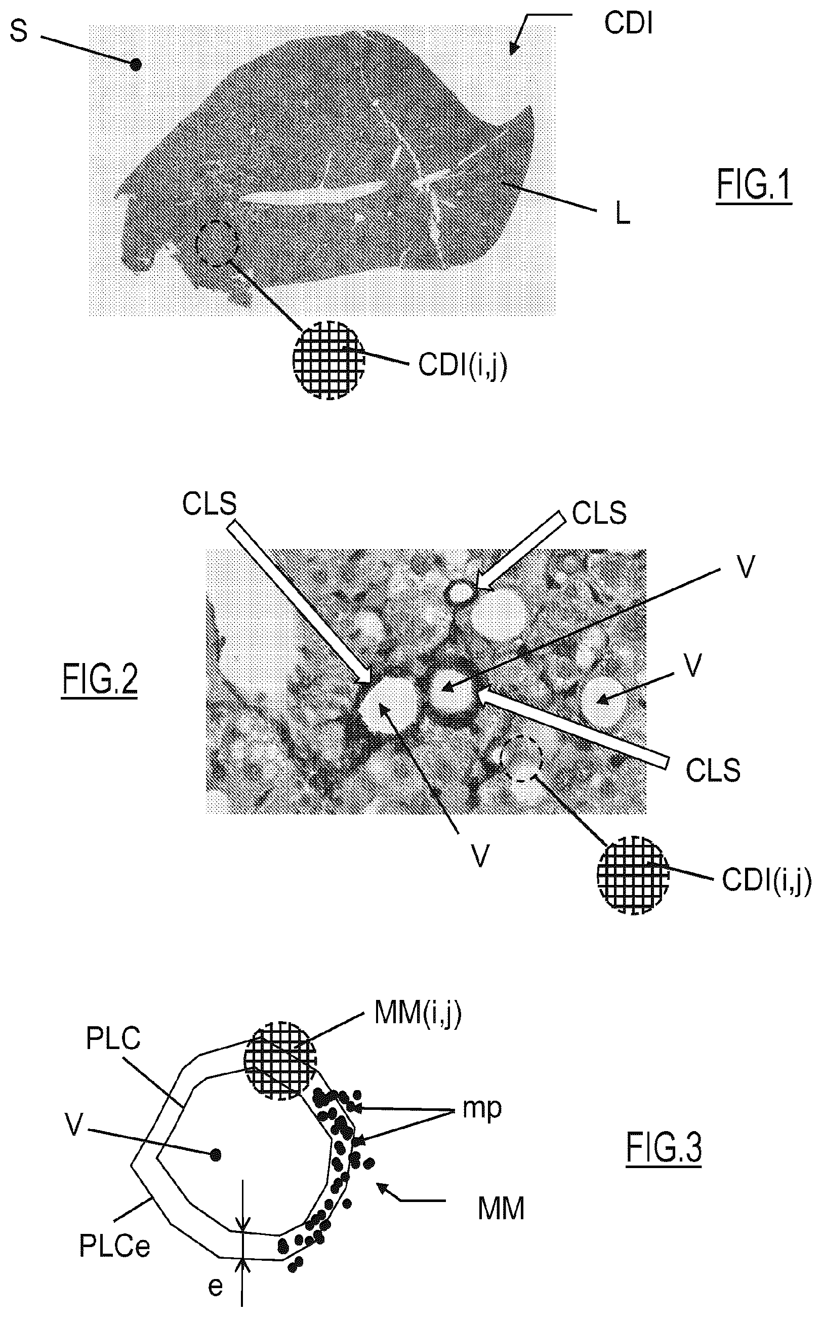 Patent US12315154 — System and method for generating an indicator from an image of a histological section — Figure 1