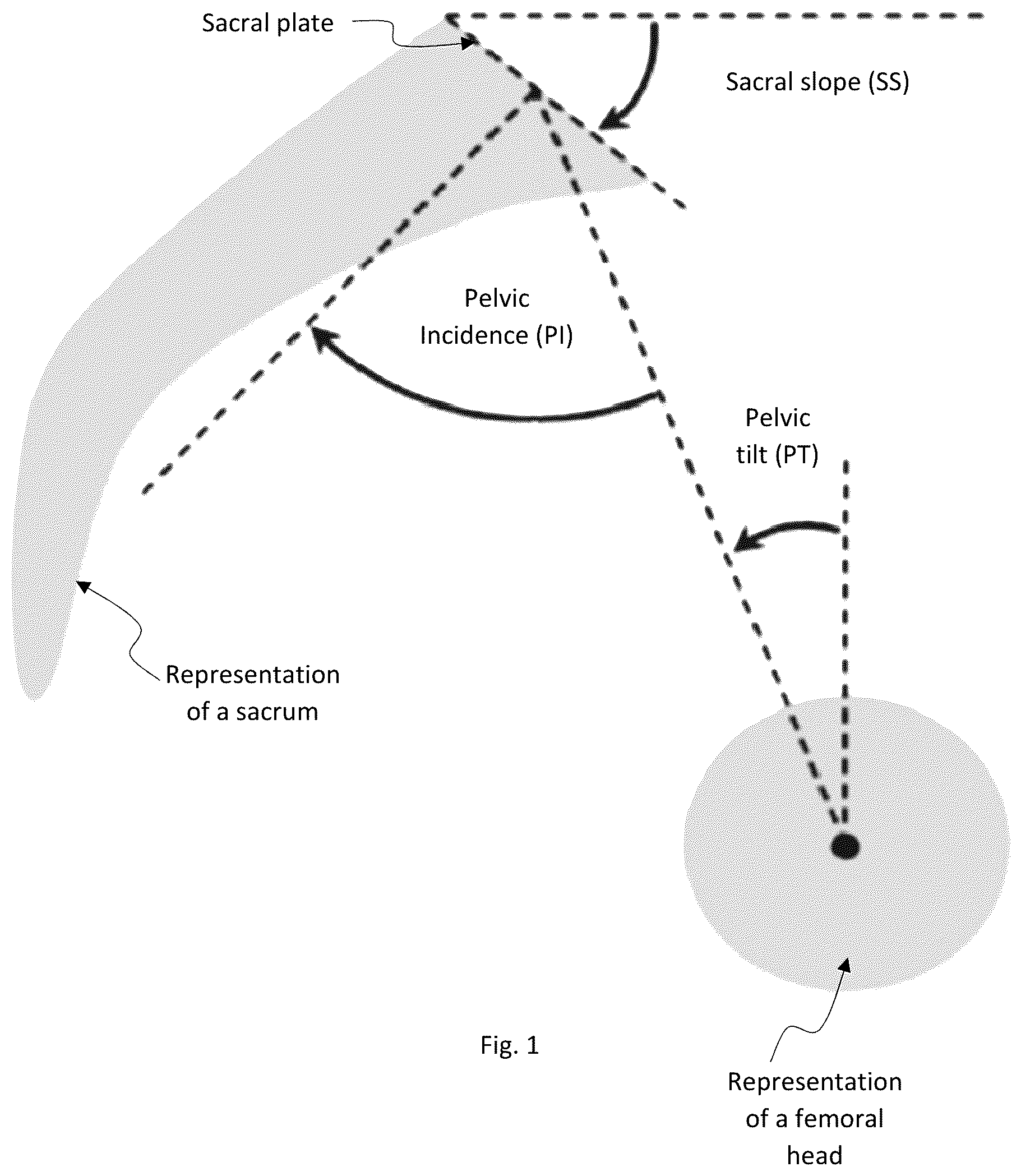 Patent US12315157 Figure 1 – System and method for patient-specific anatomical analyses