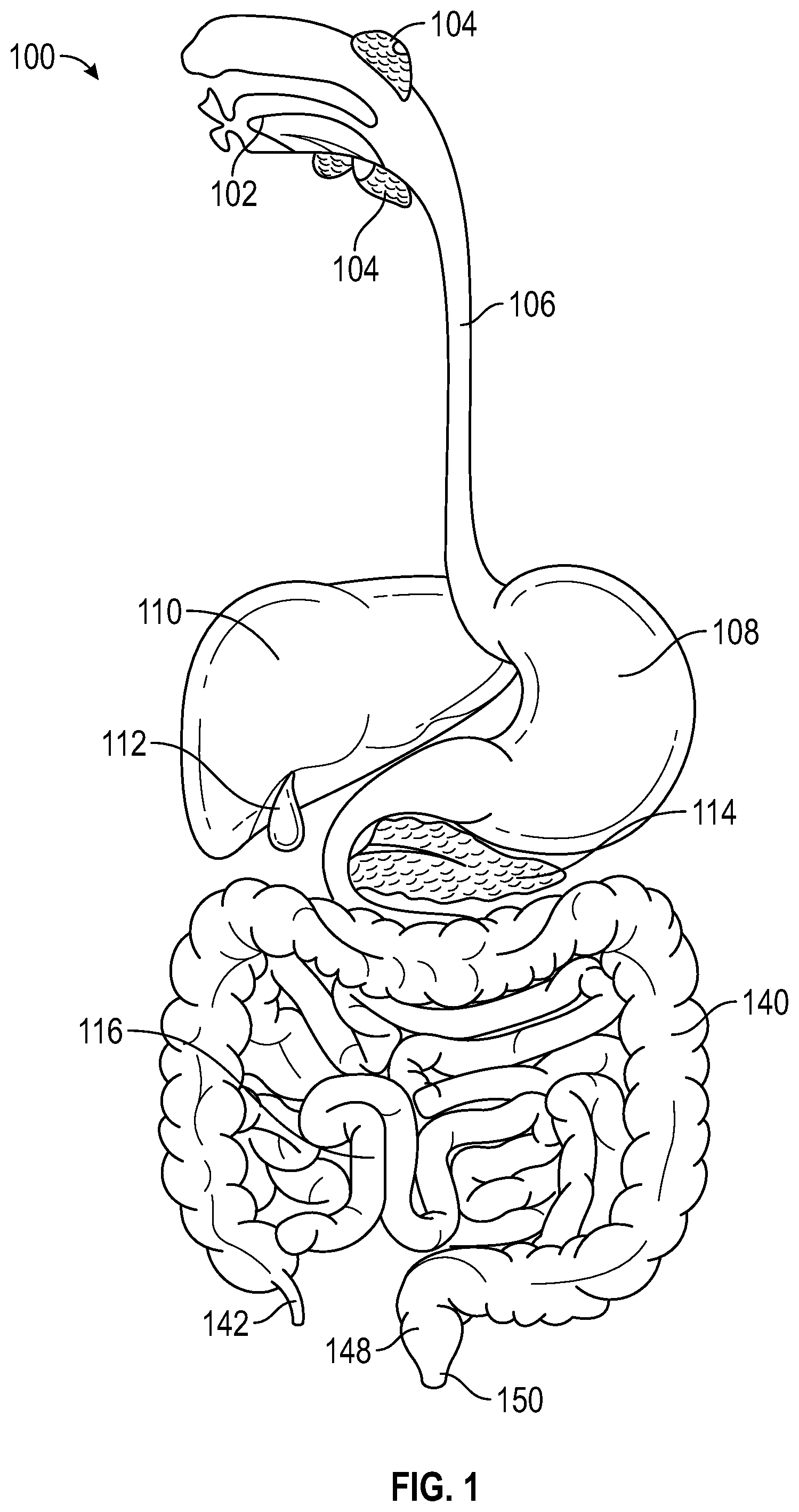 Patent US12315166 — Systems and methods for analyzing a stream of images — Figure 1