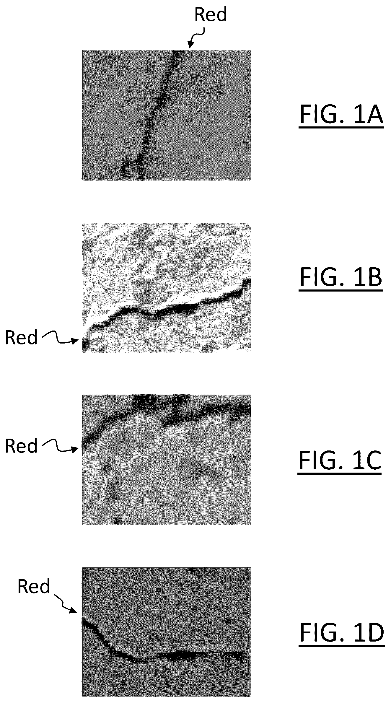 Patent US12315238 — Computer-implemented arrangements for processing image having article of interest — Figure 1