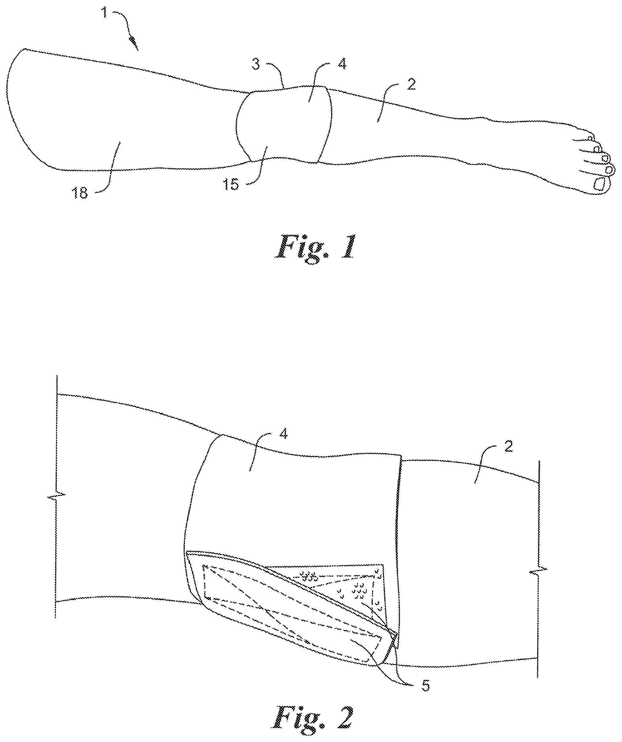 Patent US12315388 — Intraosseous infusion trainer — Figure 1