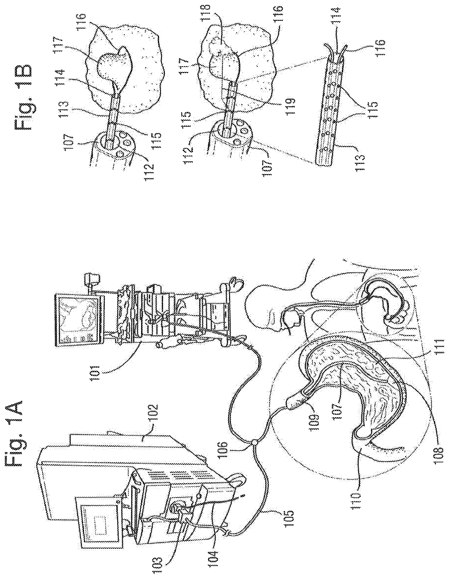Patent US12315714 — Tissue analysis by mass spectrometry or ion mobility spectrometry — Figure 1