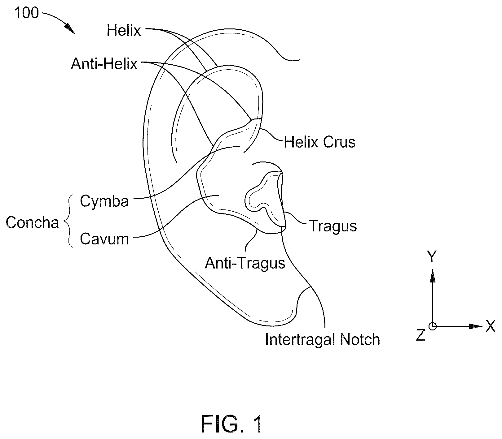Patent US12317022 Figure 1 – Raised feature on earbud body