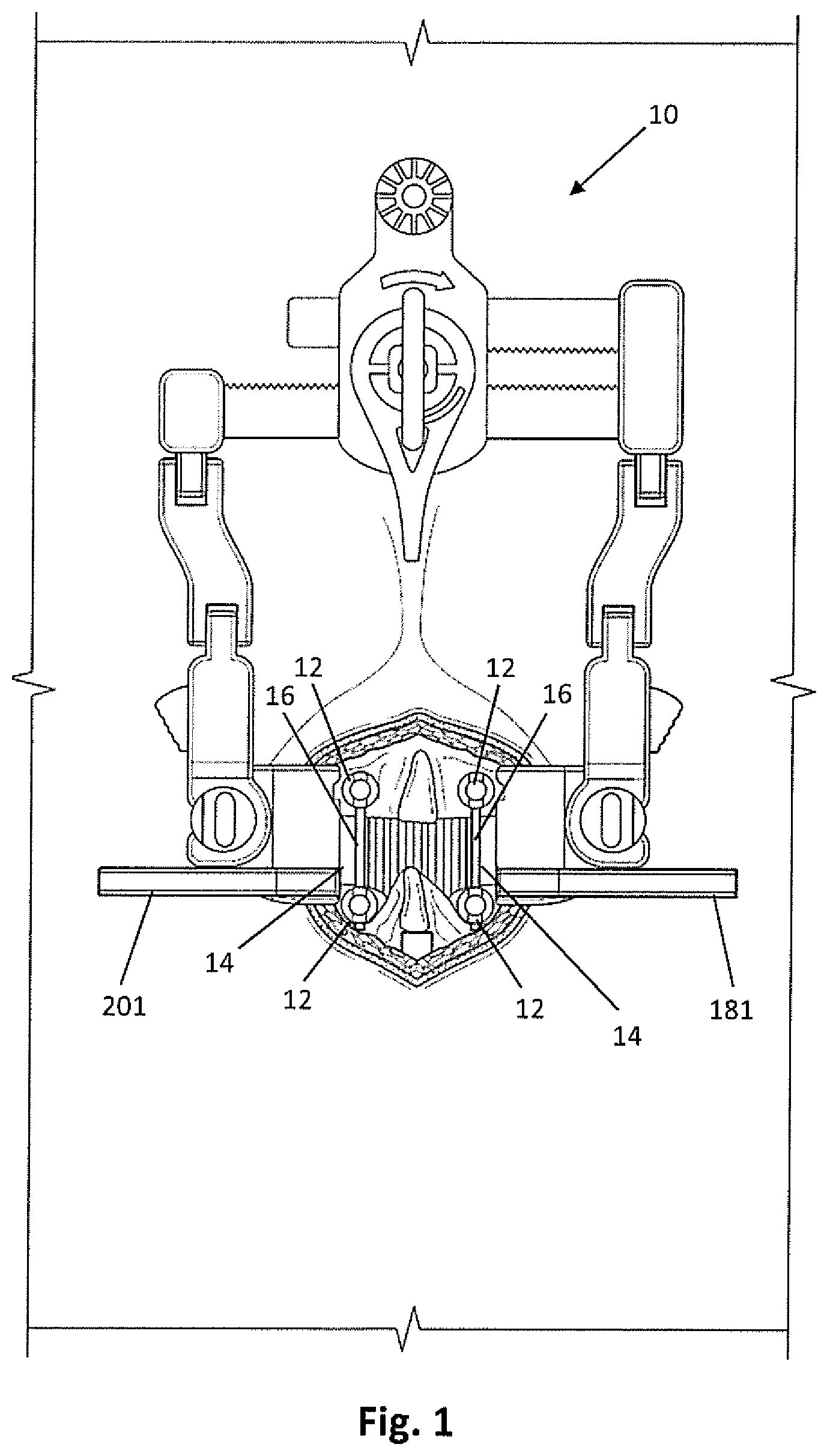 Patent US12318081 — Systems and methods for performing spine surgery — Figure 1