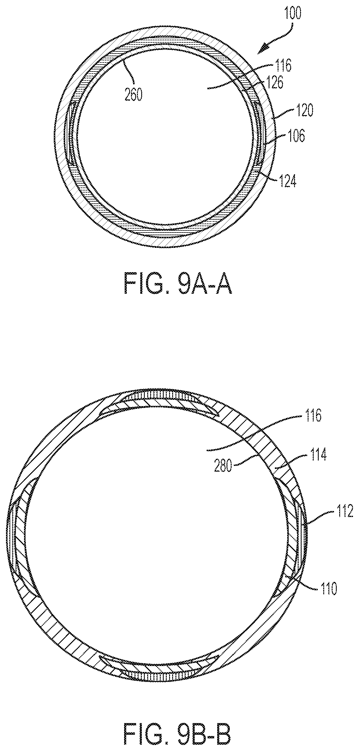 Patent US12318097 Figure 16 – Systems and methods for removing undesirable material within a circulatory system