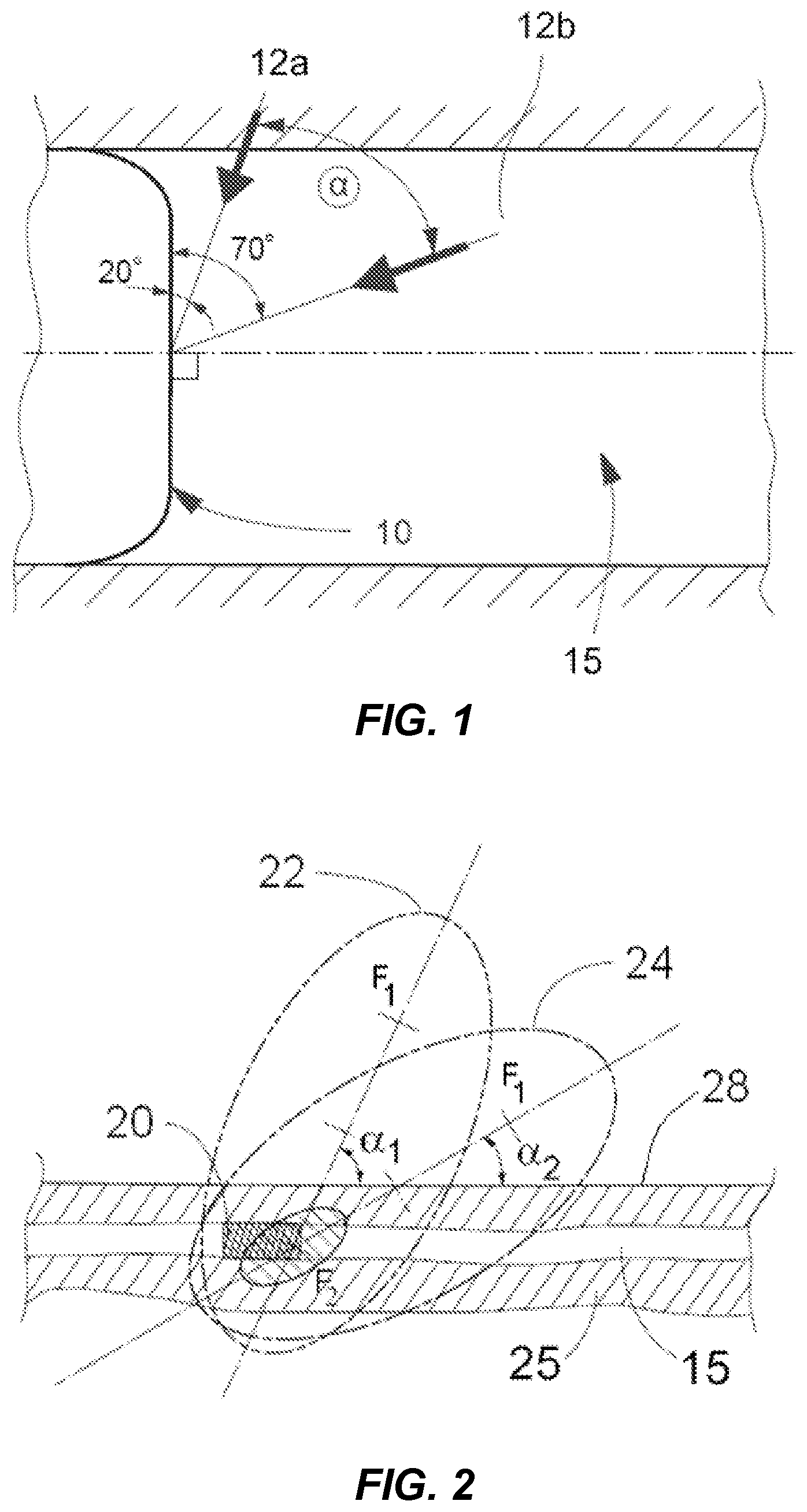 Patent US12318100 Figure 1 – Shock wave vessel catheter system and method