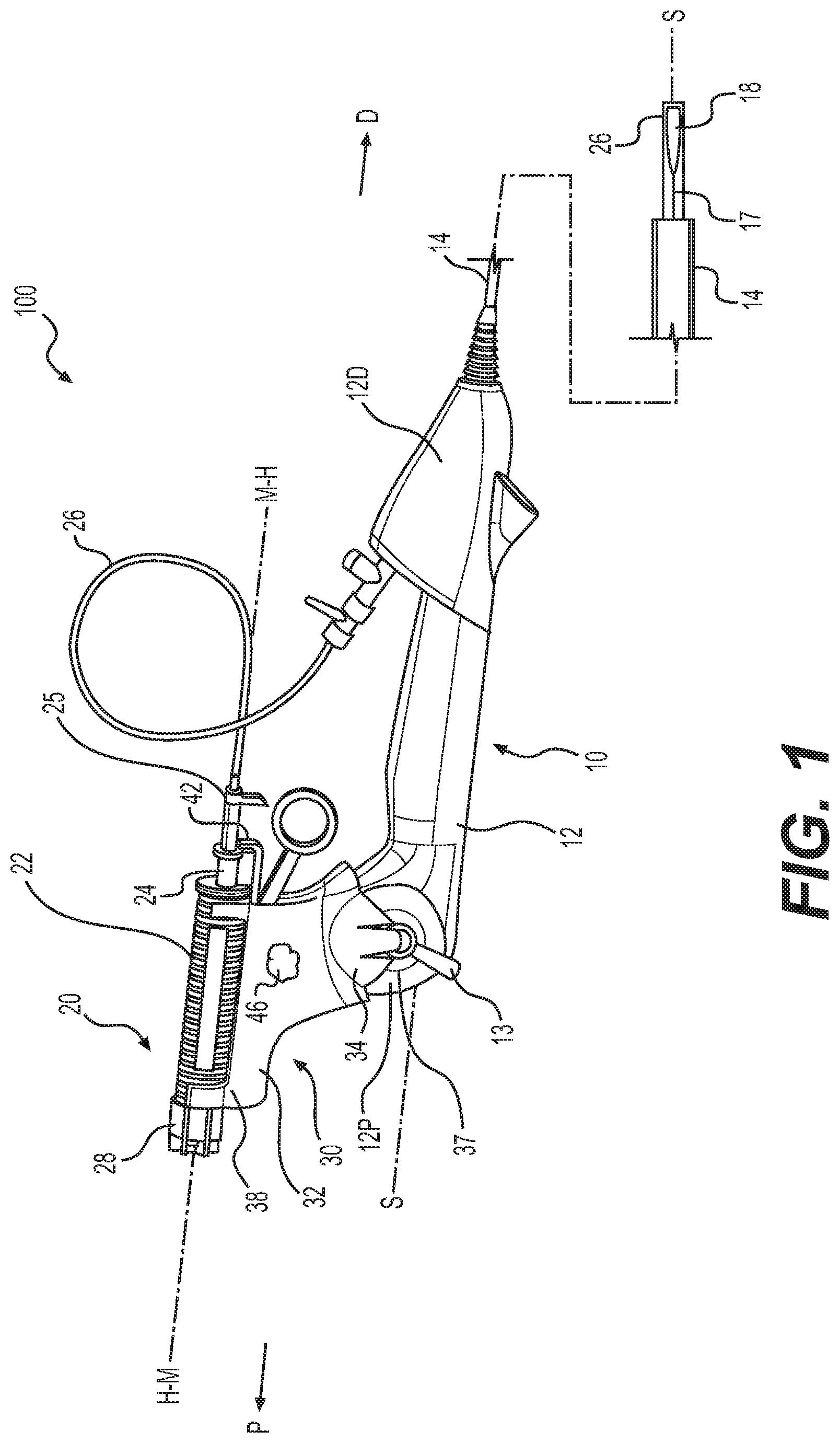Patent US12318101 Figure 1 – Actuator devices and systems