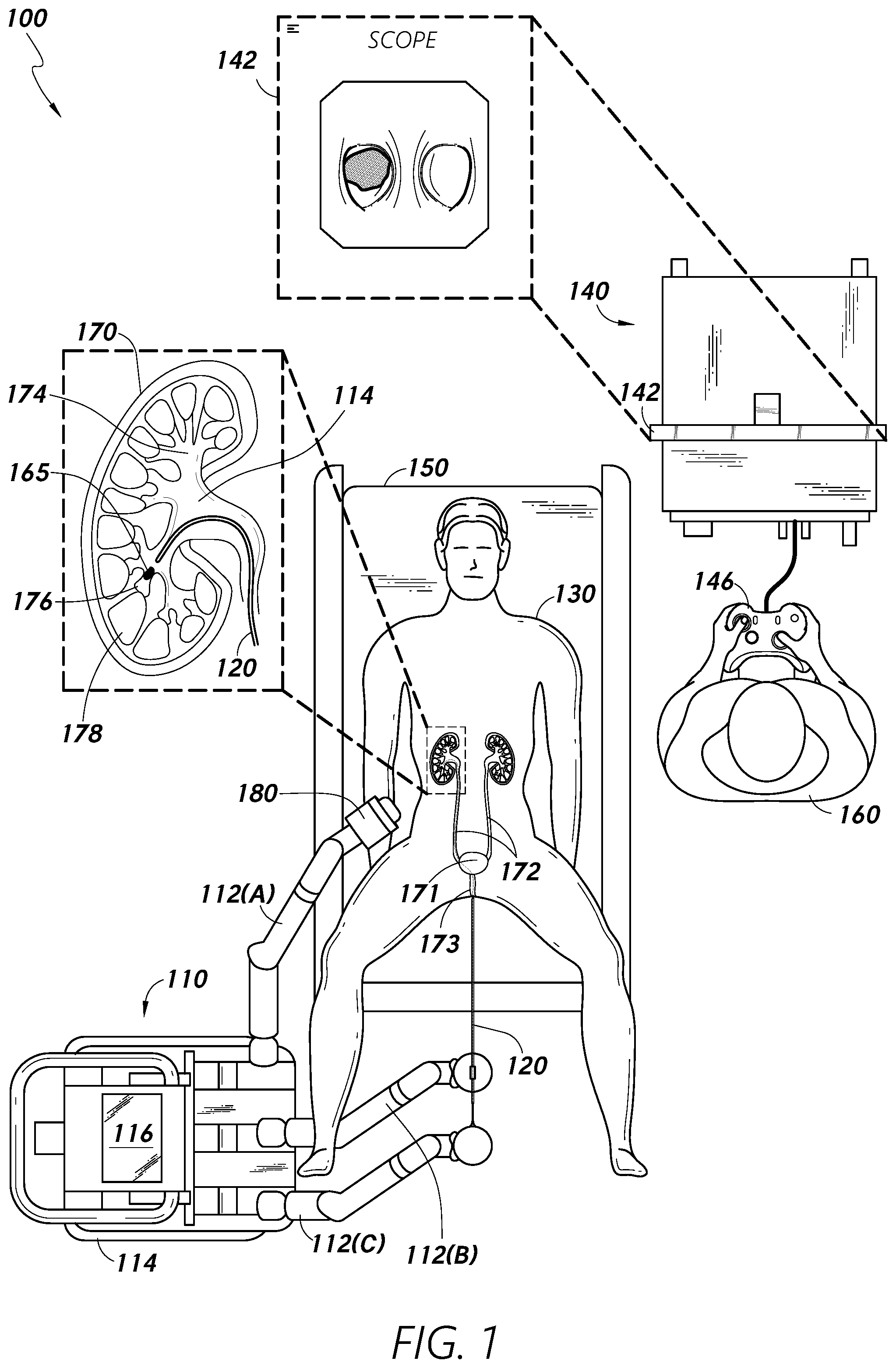 Patent US12318102 — Advanced basket drive mode — Figure 1
