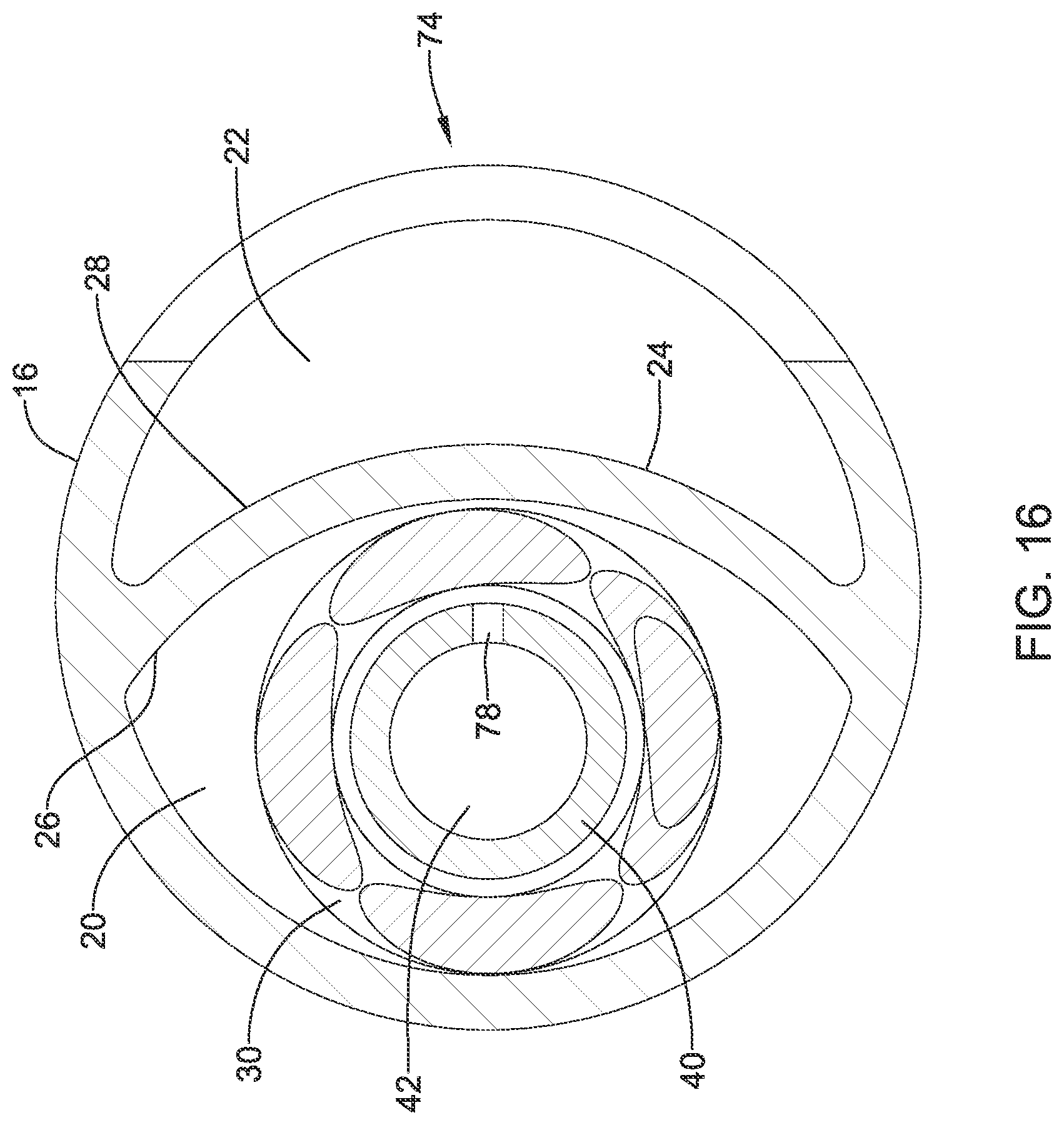 Patent US12318111 Figure 16 – Infusion lubricated atherectomy catheter